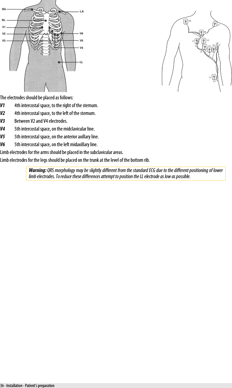     The electrodes should be placed as follows: V1 4th intercostal space, to the right of the sternum. V2 4th intercostal space, to the left of the sternum. V3 Between V2 and V4 electrodes.  V4 5th intercostal space, on the midclavicular line. V5 5th intercostal space, on the anterior axillary line. V6 5th intercostal space, on the left midaxillary line. Limb electrodes for the arms should be placed in the subclavicular areas. Limb electrodes for the legs should be placed on the trunk at the level of the bottom rib. Warning: QRS morphology may be slightly different from the standard ECG due to the different positioning of lower limb electrodes. To reduce these differences attempt to position the LL electrode as low as possible. 36 - Installation - Patient’s preparation 