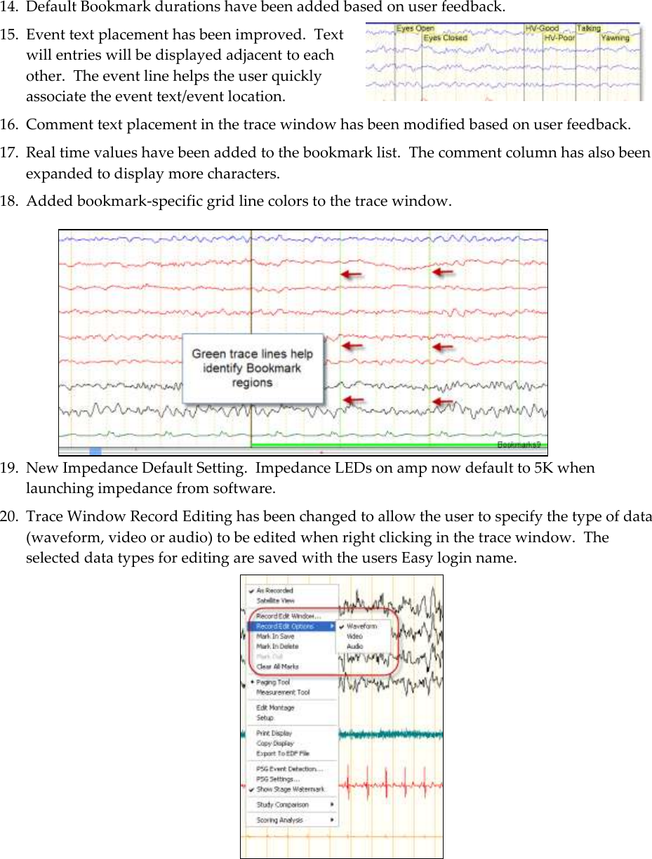  5 14. Default Bookmark durations have been added based on user feedback.   15. Event text placement has been improved.  Text will entries will be displayed adjacent to each other.  The event line helps the user quickly associate the event text/event location. 16. Comment text placement in the trace window has been modified based on user feedback.   17. Real time values have been added to the bookmark list.  The comment column has also been expanded to display more characters. 18. Added bookmark-specific grid line colors to the trace window.   19. New Impedance Default Setting.  Impedance LEDs on amp now default to 5K when launching impedance from software. 20. Trace Window Record Editing has been changed to allow the user to specify the type of data (waveform, video or audio) to be edited when right clicking in the trace window.  The selected data types for editing are saved with the users Easy login name.   