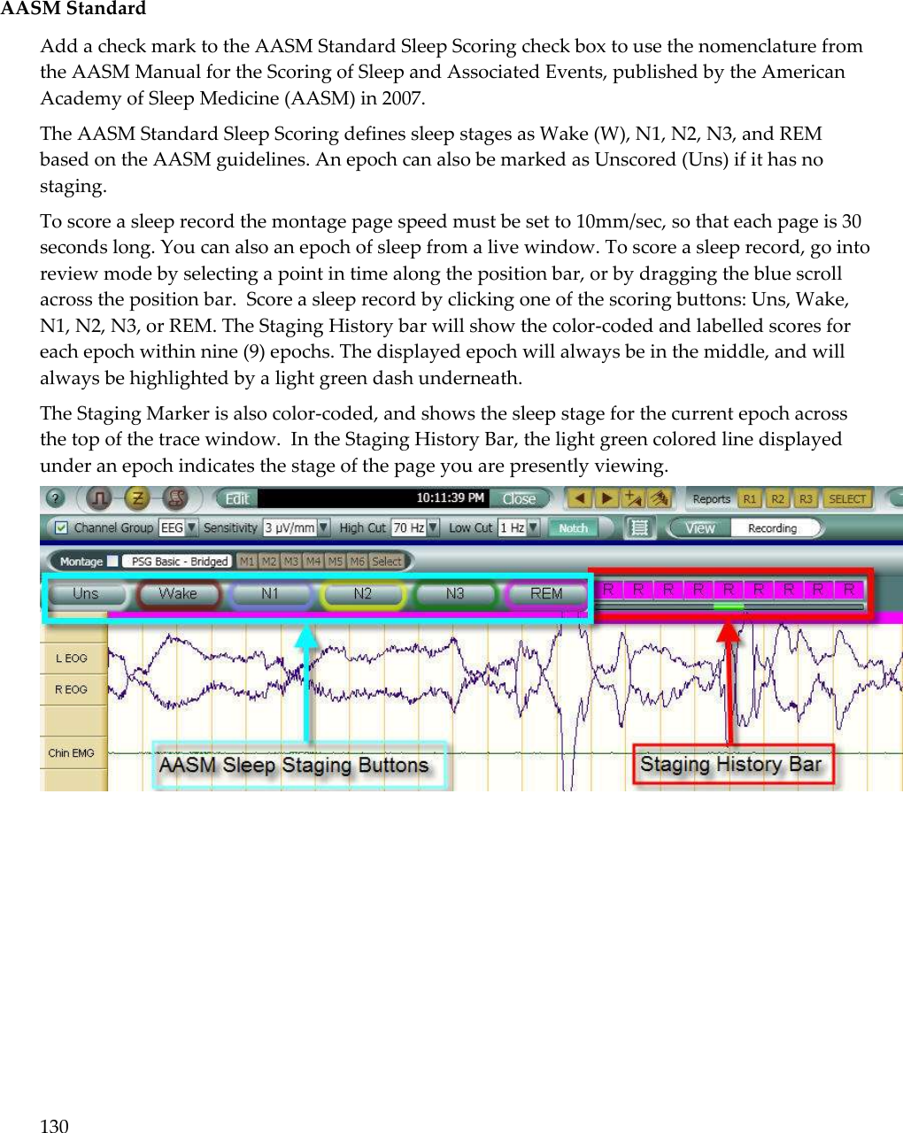 130    AASM Standard Add a check mark to the AASM Standard Sleep Scoring check box to use the nomenclature from the AASM Manual for the Scoring of Sleep and Associated Events, published by the American Academy of Sleep Medicine (AASM) in 2007.  The AASM Standard Sleep Scoring defines sleep stages as Wake (W), N1, N2, N3, and REM based on the AASM guidelines. An epoch can also be marked as Unscored (Uns) if it has no staging. To score a sleep record the montage page speed must be set to 10mm/sec, so that each page is 30 seconds long. You can also an epoch of sleep from a live window. To score a sleep record, go into review mode by selecting a point in time along the position bar, or by dragging the blue scroll across the position bar.  Score a sleep record by clicking one of the scoring buttons: Uns, Wake, N1, N2, N3, or REM. The Staging History bar will show the color-coded and labelled scores for each epoch within nine (9) epochs. The displayed epoch will always be in the middle, and will always be highlighted by a light green dash underneath.  The Staging Marker is also color-coded, and shows the sleep stage for the current epoch across the top of the trace window.  In the Staging History Bar, the light green colored line displayed under an epoch indicates the stage of the page you are presently viewing.  