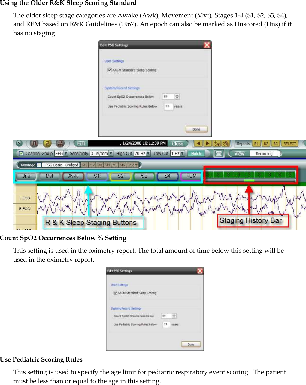  Using the Older R&amp;K Sleep Scoring Standard The older sleep stage categories are Awake (Awk), Movement (Mvt), Stages 1-4 (S1, S2, S3, S4), and REM based on R&amp;K Guidelines (1967). An epoch can also be marked as Unscored (Uns) if it has no staging.   Count SpO2 Occurrences Below % Setting This setting is used in the oximetry report. The total amount of time below this setting will be used in the oximetry report.  Use Pediatric Scoring Rules This setting is used to specify the age limit for pediatric respiratory event scoring.  The patient must be less than or equal to the age in this setting. 