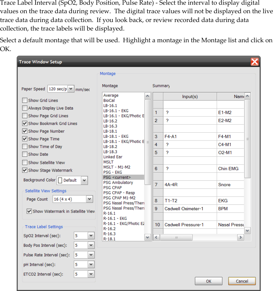 Trace Label Interval (SpO2, Body Position, Pulse Rate) - Select the interval to display digital values on the trace data during review.  The digital trace values will not be displayed on the live trace data during data collection.  If you look back, or review recorded data during data collection, the trace labels will be displayed. Select a default montage that will be used.  Highlight a montage in the Montage list and click on OK.  