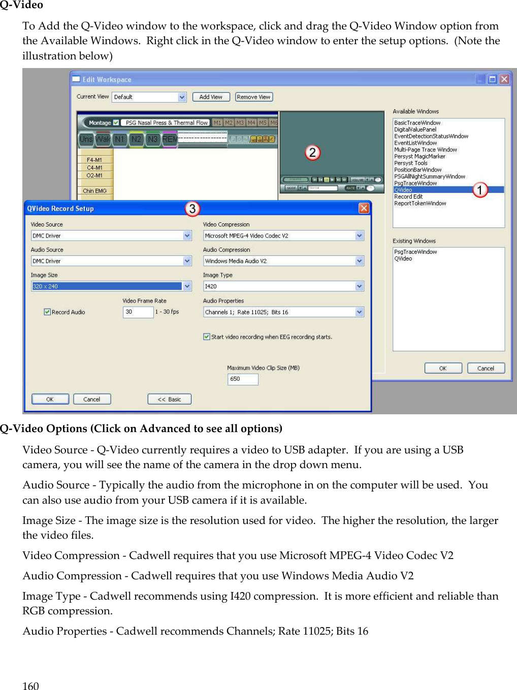 160  Q-Video To Add the Q-Video window to the workspace, click and drag the Q-Video Window option from the Available Windows.  Right click in the Q-Video window to enter the setup options.  (Note the illustration below)  Q-Video Options (Click on Advanced to see all options) Video Source - Q-Video currently requires a video to USB adapter.  If you are using a USB camera, you will see the name of the camera in the drop down menu. Audio Source - Typically the audio from the microphone in on the computer will be used.  You can also use audio from your USB camera if it is available. Image Size - The image size is the resolution used for video.  The higher the resolution, the larger the video files. Video Compression - Cadwell requires that you use Microsoft MPEG-4 Video Codec V2 Audio Compression - Cadwell requires that you use Windows Media Audio V2 Image Type - Cadwell recommends using I420 compression.  It is more efficient and reliable than RGB compression. Audio Properties - Cadwell recommends Channels; Rate 11025; Bits 16 