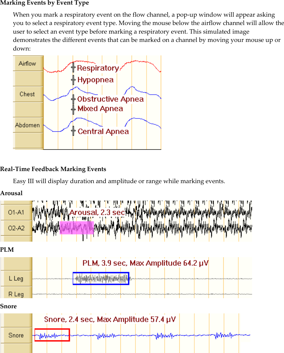   Marking Events by Event Type When you mark a respiratory event on the flow channel, a pop-up window will appear asking you to select a respiratory event type. Moving the mouse below the airflow channel will allow the user to select an event type before marking a respiratory event. This simulated image demonstrates the different events that can be marked on a channel by moving your mouse up or down:   Real-Time Feedback Marking Events Easy III will display duration and amplitude or range while marking events. Arousal  PLM  Snore   