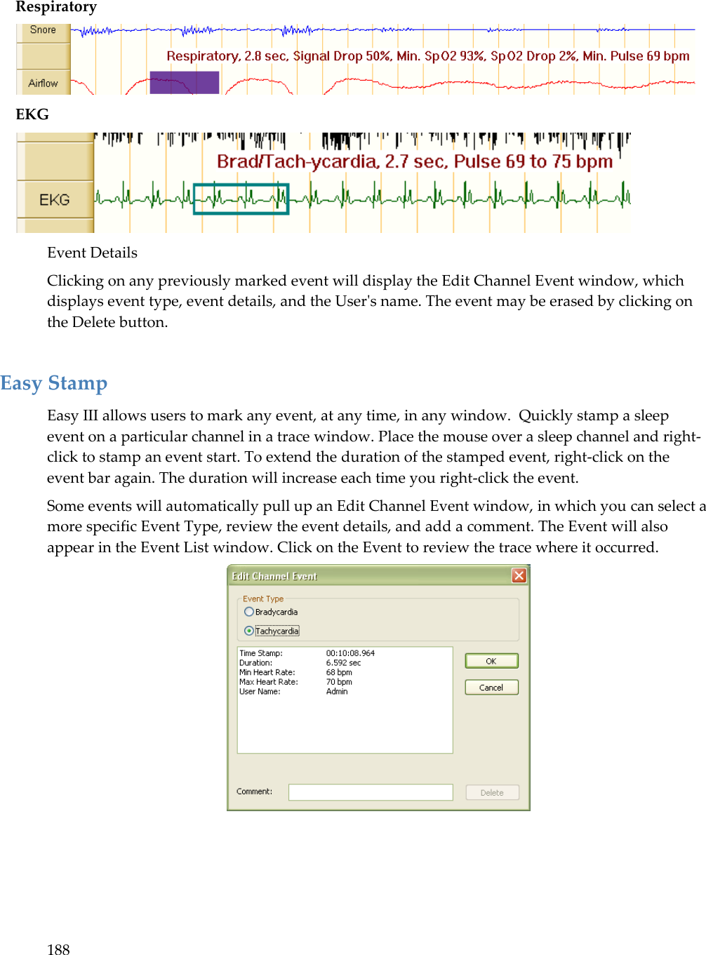 188  Respiratory  EKG  Event Details Clicking on any previously marked event will display the Edit Channel Event window, which displays event type, event details, and the User&apos;s name. The event may be erased by clicking on the Delete button.  Easy Stamp Easy III allows users to mark any event, at any time, in any window.  Quickly stamp a sleep event on a particular channel in a trace window. Place the mouse over a sleep channel and right-click to stamp an event start. To extend the duration of the stamped event, right-click on the event bar again. The duration will increase each time you right-click the event.  Some events will automatically pull up an Edit Channel Event window, in which you can select a more specific Event Type, review the event details, and add a comment. The Event will also appear in the Event List window. Click on the Event to review the trace where it occurred.  