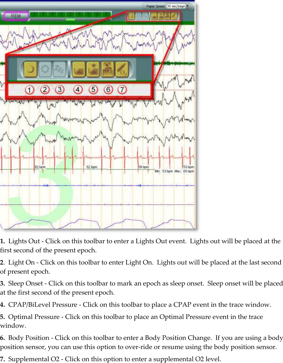   1.  Lights Out - Click on this toolbar to enter a Lights Out event.  Lights out will be placed at the first second of the present epoch. 2.  Light On - Click on this toolbar to enter Light On.  Lights out will be placed at the last second of present epoch. 3.  Sleep Onset - Click on this toolbar to mark an epoch as sleep onset.  Sleep onset will be placed at the first second of the present epoch. 4.  CPAP/BiLevel Pressure - Click on this toolbar to place a CPAP event in the trace window.   5.  Optimal Pressure - Click on this toolbar to place an Optimal Pressure event in the trace window. 6.  Body Position - Click on this toolbar to enter a Body Position Change.  If you are using a body position sensor, you can use this option to over-ride or resume using the body position sensor. 7.  Supplemental O2 - Click on this option to enter a supplemental O2 level.  