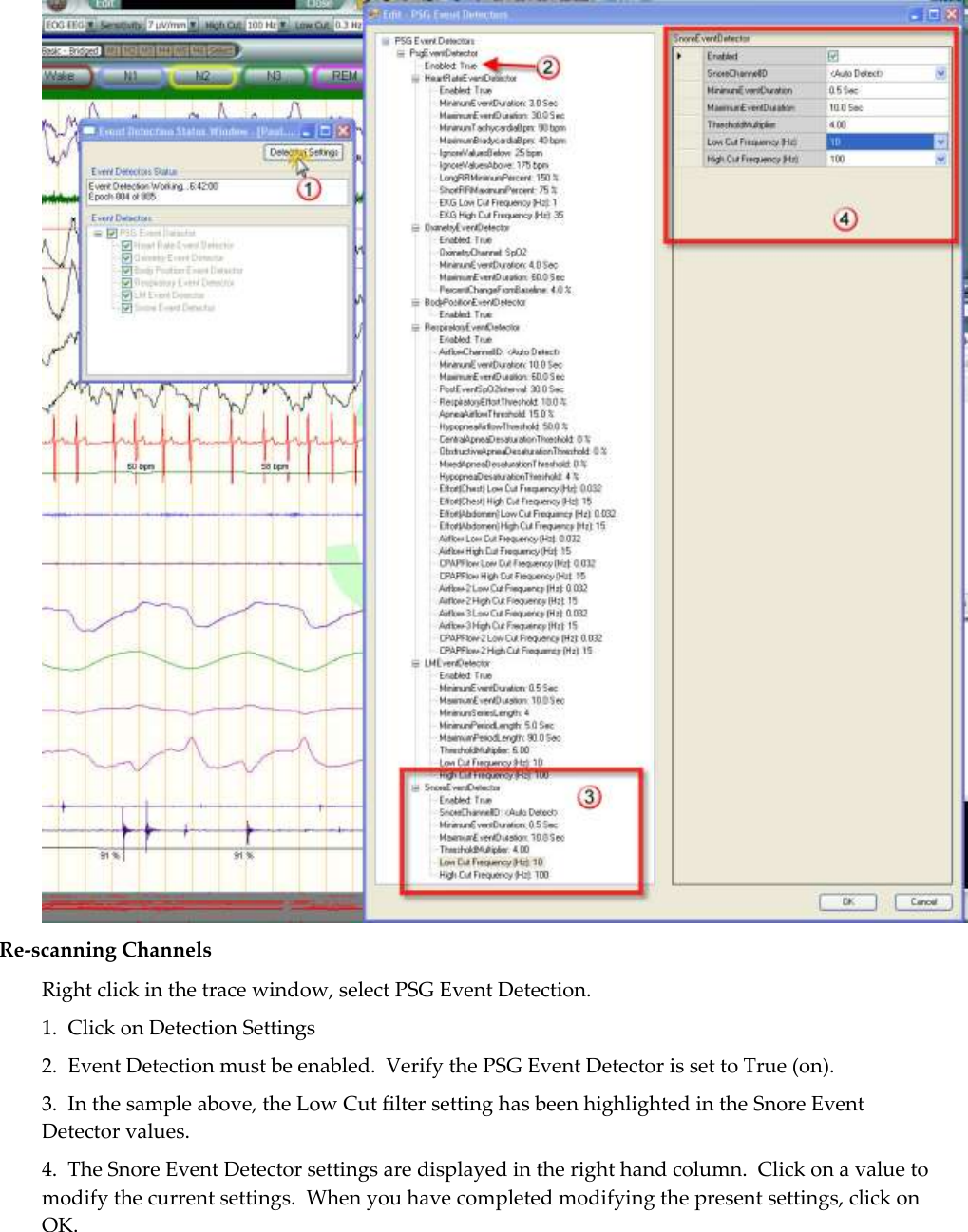   Re-scanning Channels Right click in the trace window, select PSG Event Detection. 1.  Click on Detection Settings 2.  Event Detection must be enabled.  Verify the PSG Event Detector is set to True (on). 3.  In the sample above, the Low Cut filter setting has been highlighted in the Snore Event Detector values. 4.  The Snore Event Detector settings are displayed in the right hand column.  Click on a value to modify the current settings.  When you have completed modifying the present settings, click on OK.  