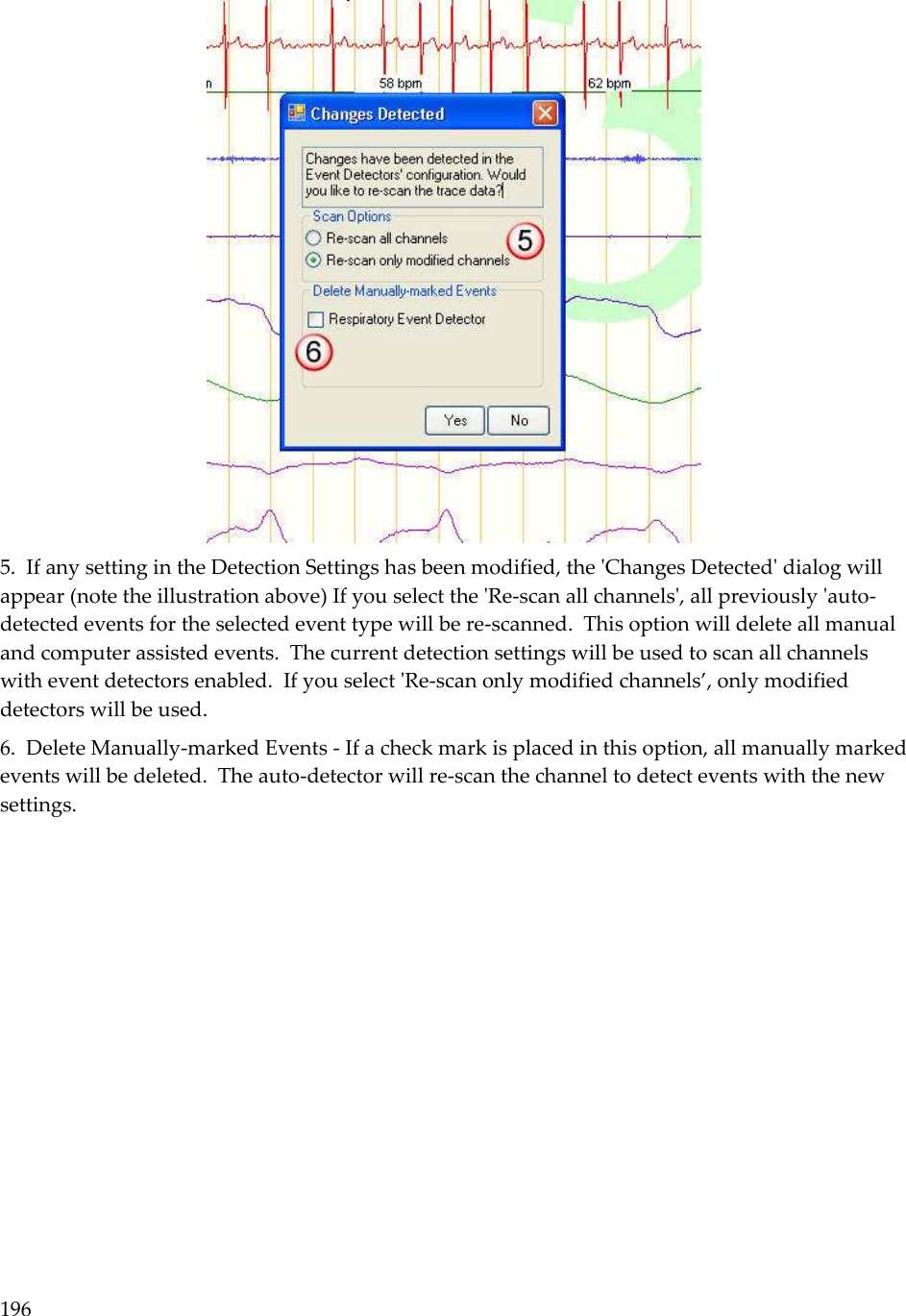 196   5.  If any setting in the Detection Settings has been modified, the &apos;Changes Detected&apos; dialog will appear (note the illustration above) If you select the &apos;Re-scan all channels&apos;, all previously &apos;auto-detected events for the selected event type will be re-scanned.  This option will delete all manual and computer assisted events.  The current detection settings will be used to scan all channels with event detectors enabled.  If you select &apos;Re-scan only modified channels’, only modified detectors will be used. 6.  Delete Manually-marked Events - If a check mark is placed in this option, all manually marked events will be deleted.  The auto-detector will re-scan the channel to detect events with the new settings.     