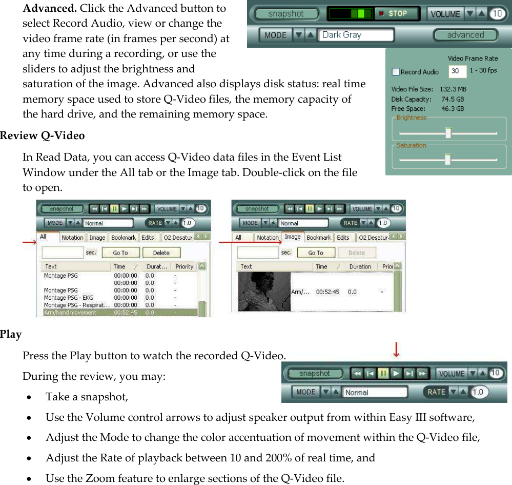  Advanced. Click the Advanced button to  select Record Audio, view or change the video frame rate (in frames per second) at any time during a recording, or use the sliders to adjust the brightness and saturation of the image. Advanced also displays disk status: real time memory space used to store Q-Video files, the memory capacity of the hard drive, and the remaining memory space.  Review Q-Video In Read Data, you can access Q-Video data files in the Event List Window under the All tab or the Image tab. Double-click on the file to open.  Play  Press the Play button to watch the recorded Q-Video.  During the review, you may:  Take a snapshot,   Use the Volume control arrows to adjust speaker output from within Easy III software,  Adjust the Mode to change the color accentuation of movement within the Q-Video file,  Adjust the Rate of playback between 10 and 200% of real time, and   Use the Zoom feature to enlarge sections of the Q-Video file. 