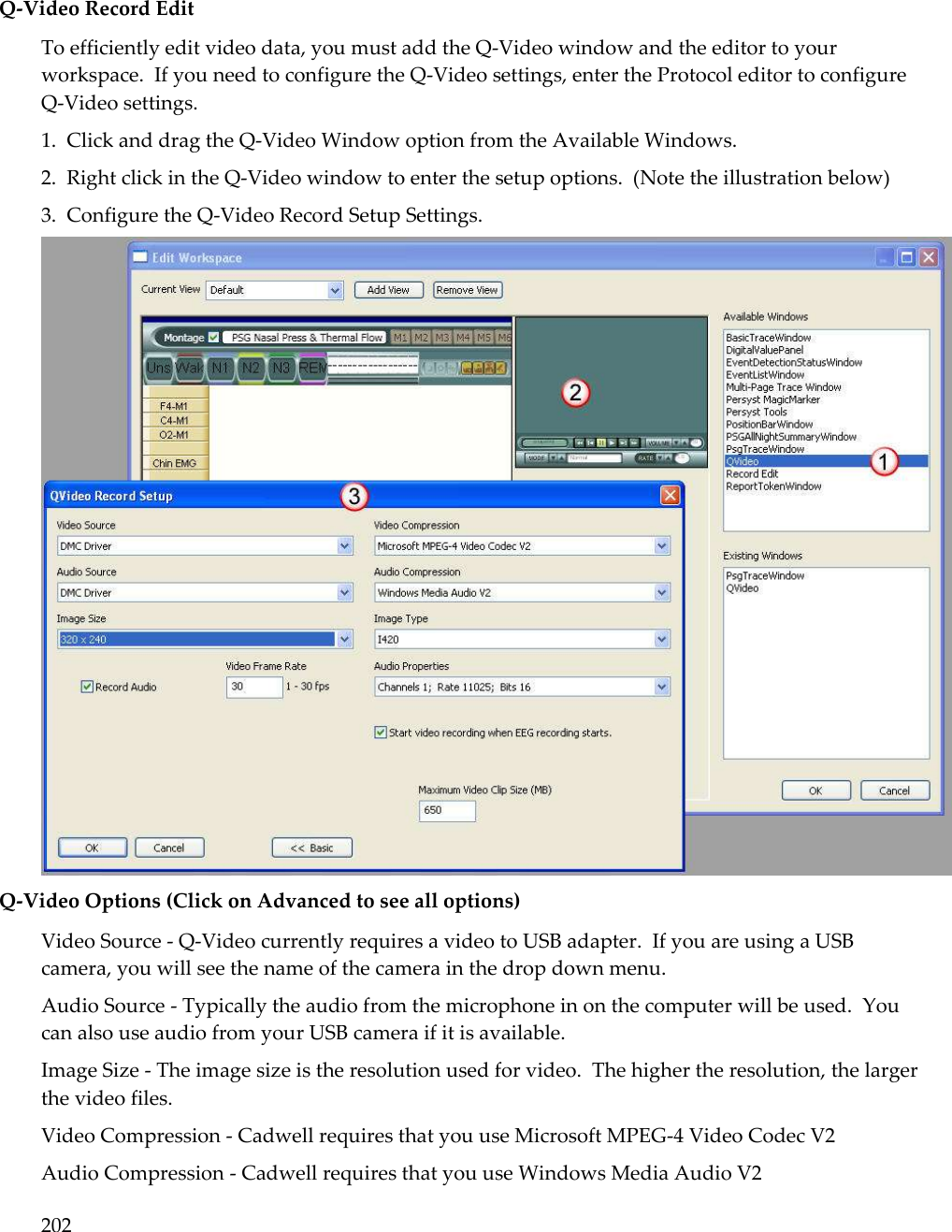 202   Q-Video Record Edit To efficiently edit video data, you must add the Q-Video window and the editor to your workspace.  If you need to configure the Q-Video settings, enter the Protocol editor to configure Q-Video settings. 1.  Click and drag the Q-Video Window option from the Available Windows.  2.  Right click in the Q-Video window to enter the setup options.  (Note the illustration below) 3.  Configure the Q-Video Record Setup Settings.  Q-Video Options (Click on Advanced to see all options) Video Source - Q-Video currently requires a video to USB adapter.  If you are using a USB camera, you will see the name of the camera in the drop down menu. Audio Source - Typically the audio from the microphone in on the computer will be used.  You can also use audio from your USB camera if it is available. Image Size - The image size is the resolution used for video.  The higher the resolution, the larger the video files. Video Compression - Cadwell requires that you use Microsoft MPEG-4 Video Codec V2 Audio Compression - Cadwell requires that you use Windows Media Audio V2 