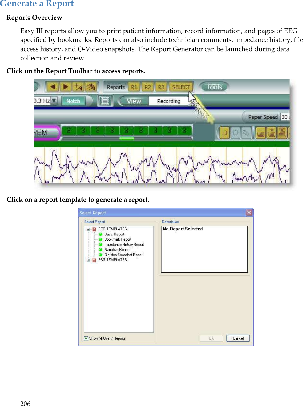 206   Generate a Report Reports Overview Easy III reports allow you to print patient information, record information, and pages of EEG specified by bookmarks. Reports can also include technician comments, impedance history, file access history, and Q-Video snapshots. The Report Generator can be launched during data collection and review. Click on the Report Toolbar to access reports.  Click on a report template to generate a report.      
