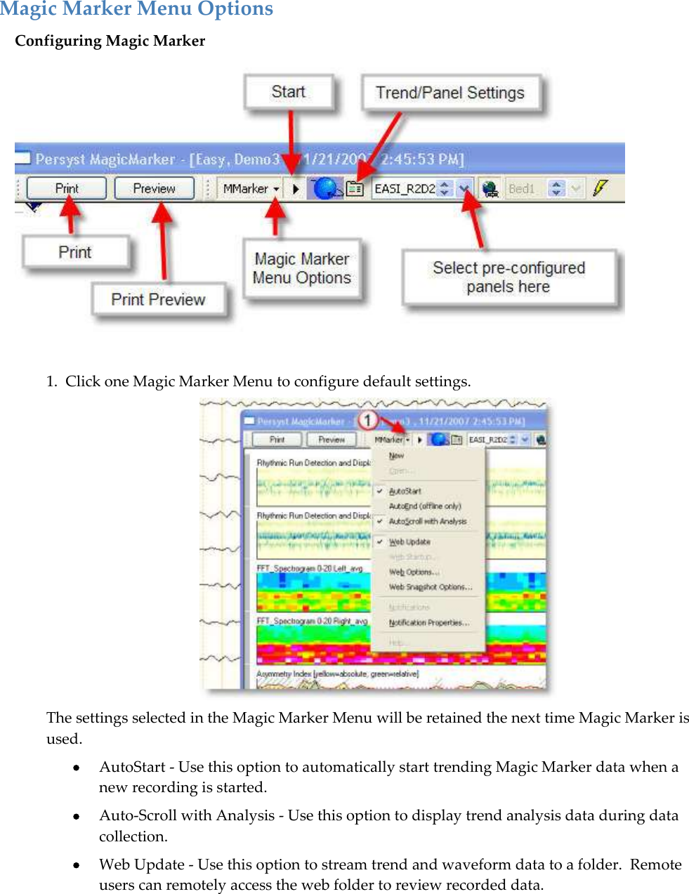   Magic Marker Menu Options Configuring Magic Marker  1.  Click one Magic Marker Menu to configure default settings.  The settings selected in the Magic Marker Menu will be retained the next time Magic Marker is used.  AutoStart - Use this option to automatically start trending Magic Marker data when a new recording is started.  Auto-Scroll with Analysis - Use this option to display trend analysis data during data collection.  Web Update - Use this option to stream trend and waveform data to a folder.  Remote users can remotely access the web folder to review recorded data. 