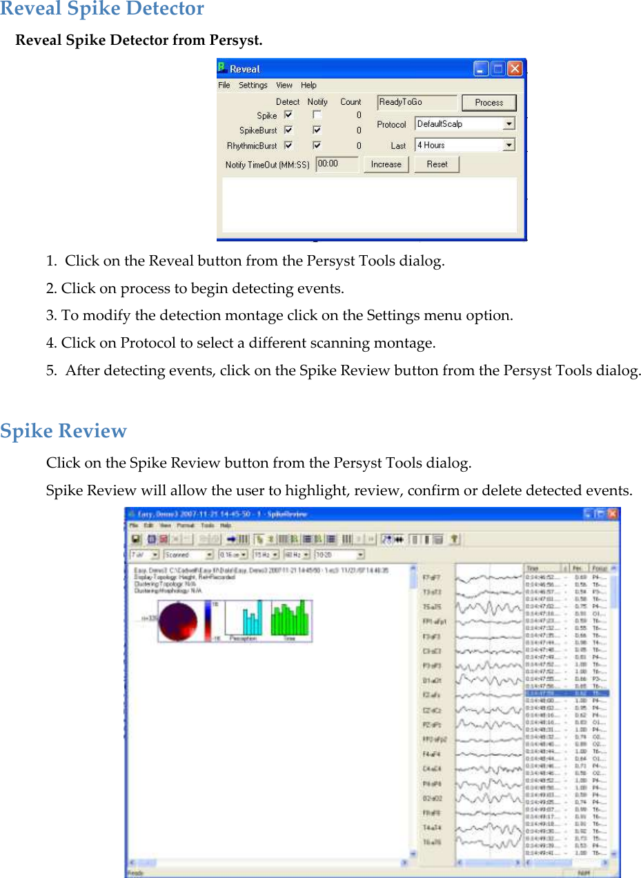  Reveal Spike Detector Reveal Spike Detector from Persyst.  1.  Click on the Reveal button from the Persyst Tools dialog. 2. Click on process to begin detecting events. 3. To modify the detection montage click on the Settings menu option. 4. Click on Protocol to select a different scanning montage. 5.  After detecting events, click on the Spike Review button from the Persyst Tools dialog.  Spike Review Click on the Spike Review button from the Persyst Tools dialog. Spike Review will allow the user to highlight, review, confirm or delete detected events.  