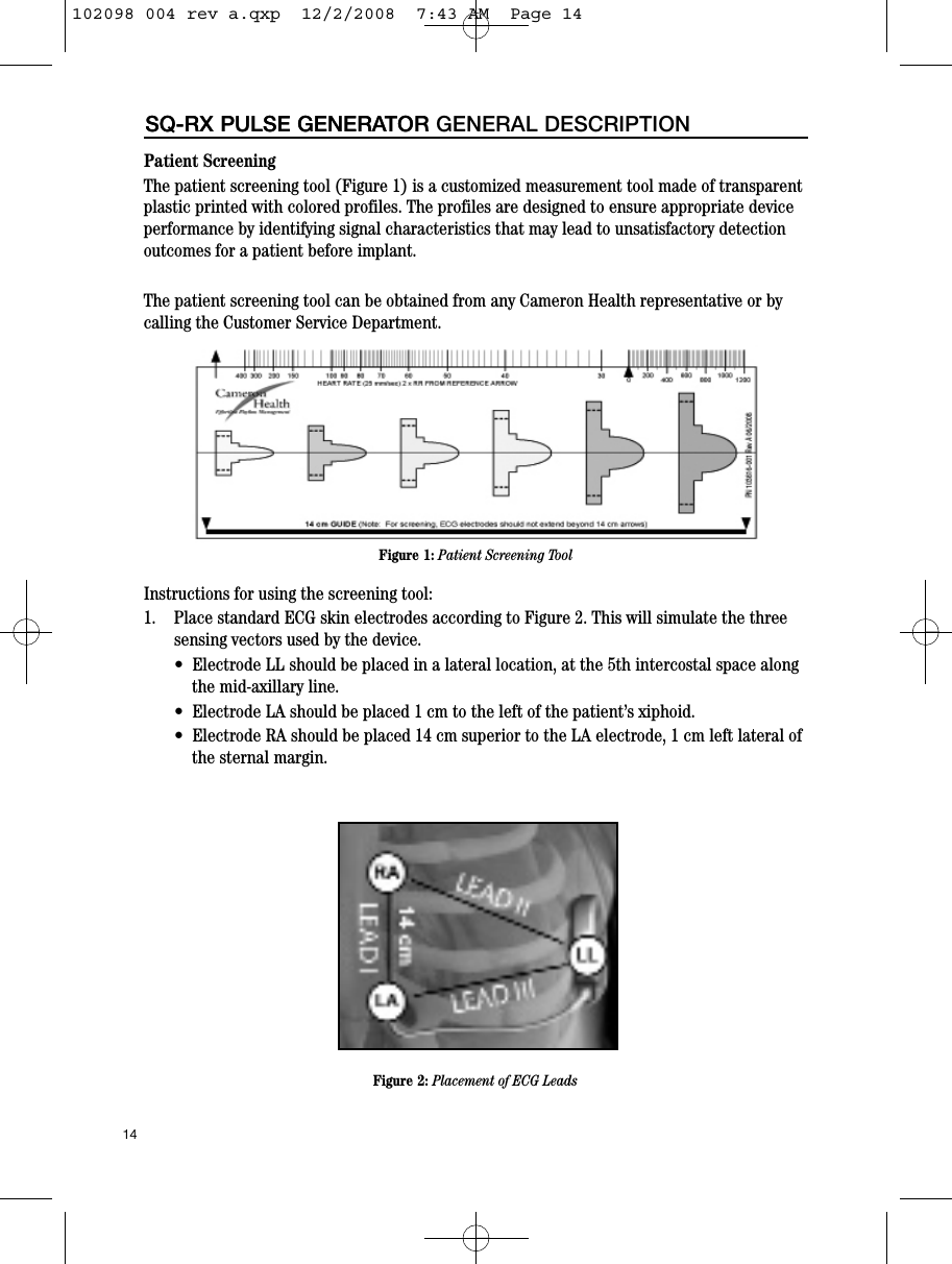 14SQ-RX PULSE GENERATORInstructions for using the screening tool:1.    Place standard ECG skin electrodes according to Figure 2. This will simulate the threesensing vectors used by the device.•  Electrode LL should be placed in a lateral location, at the 5th intercostal space alongthe mid-axillary line.•  Electrode LA should be placed 1 cm to the left of the patient’s xiphoid.•  Electrode RA should be placed 14 cm superior to the LA electrode, 1 cm left lateral ofthe sternal margin.SQ-RX PULSE GENERATOR GENERAL DESCRIPTIONFigure 1: Patient Screening ToolFigure 2: Placement of ECG LeadsPatient ScreeningThe patient screening tool (Figure 1) is a customized measurement tool made of transparentplastic printed with colored profiles. The profiles are designed to ensure appropriate deviceperformance by identifying signal characteristics that may lead to unsatisfactory detectionoutcomes for a patient before implant.The patient screening tool can be obtained from any Cameron Health representative or bycalling the Customer Service Department.102098 004 rev a.qxp  12/2/2008  7:43 AM  Page 14