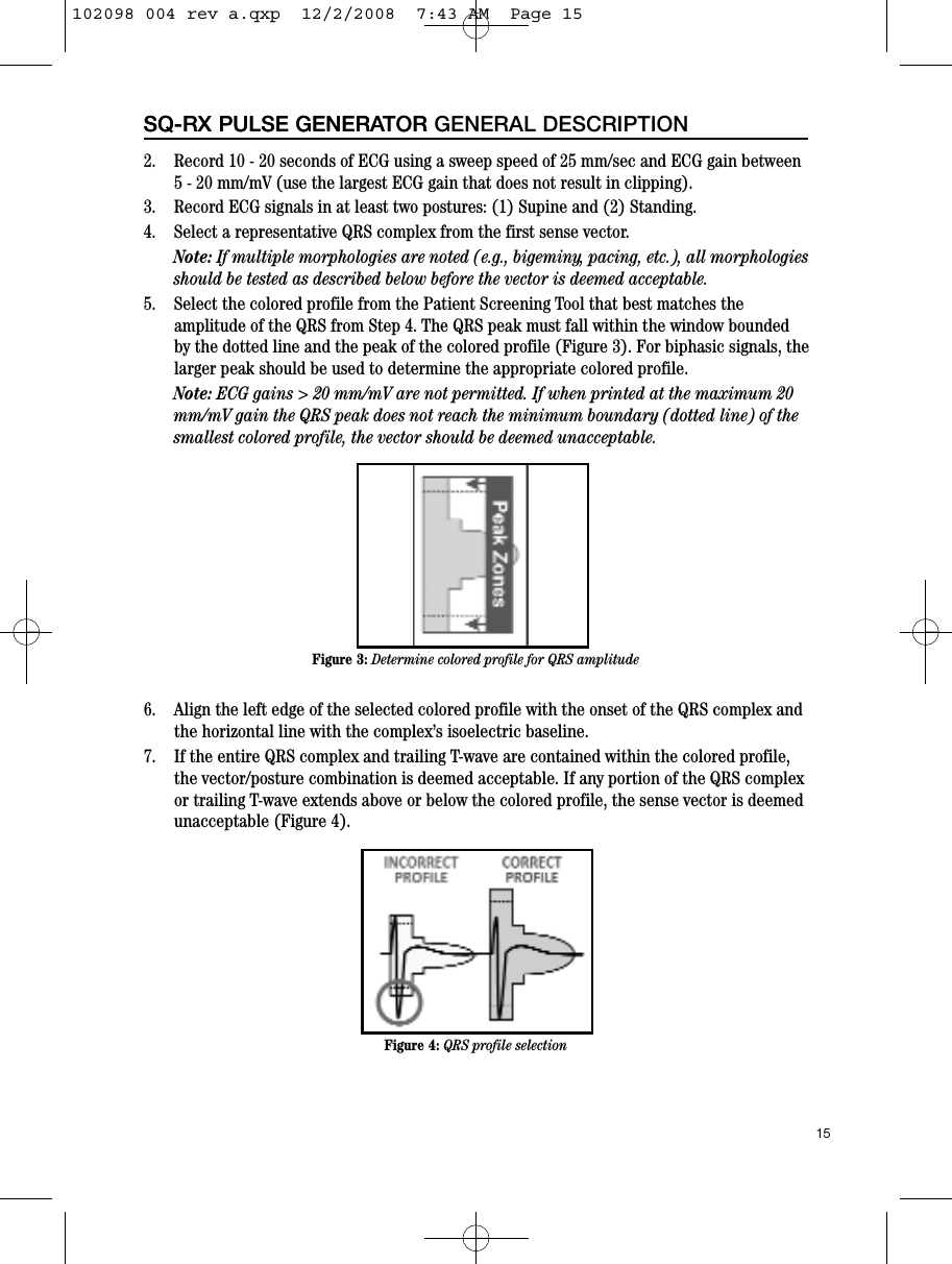 15SQ-RX PULSE GENERATOR2.    Record 10 - 20 seconds of ECG using a sweep speed of 25 mm/sec and ECG gain between5 - 20 mm/mV (use the largest ECG gain that does not result in clipping).3.    Record ECG signals in at least two postures: (1) Supine and (2) Standing. 4.    Select a representative QRS complex from the first sense vector. Note: If multiple morphologies are noted (e.g., bigeminy, pacing, etc.), all morphologiesshould be tested as described below before the vector is deemed acceptable. 5.    Select the colored profile from the Patient Screening Tool that best matches theamplitude of the QRS from Step 4. The QRS peak must fall within the window boundedby the dotted line and the peak of the colored profile (Figure 3). For biphasic signals, thelarger peak should be used to determine the appropriate colored profile.   Note: ECG gains &gt; 20 mm/mV are not permitted. If when printed at the maximum 20mm/mV gain the QRS peak does not reach the minimum boundary (dotted line) of thesmallest colored profile, the vector should be deemed unacceptable.6.    Align the left edge of the selected colored profile with the onset of the QRS complex andthe horizontal line with the complex’s isoelectric baseline.7.    If the entire QRS complex and trailing T-wave are contained within the colored profile,the vector/posture combination is deemed acceptable. If any portion of the QRS complexor trailing T-wave extends above or below the colored profile, the sense vector is deemedunacceptable (Figure 4).SQ-RX PULSE GENERATOR GENERAL DESCRIPTIONFigure 3: Determine colored profile for QRS amplitudeFigure 4: QRS profile selection102098 004 rev a.qxp  12/2/2008  7:43 AM  Page 15