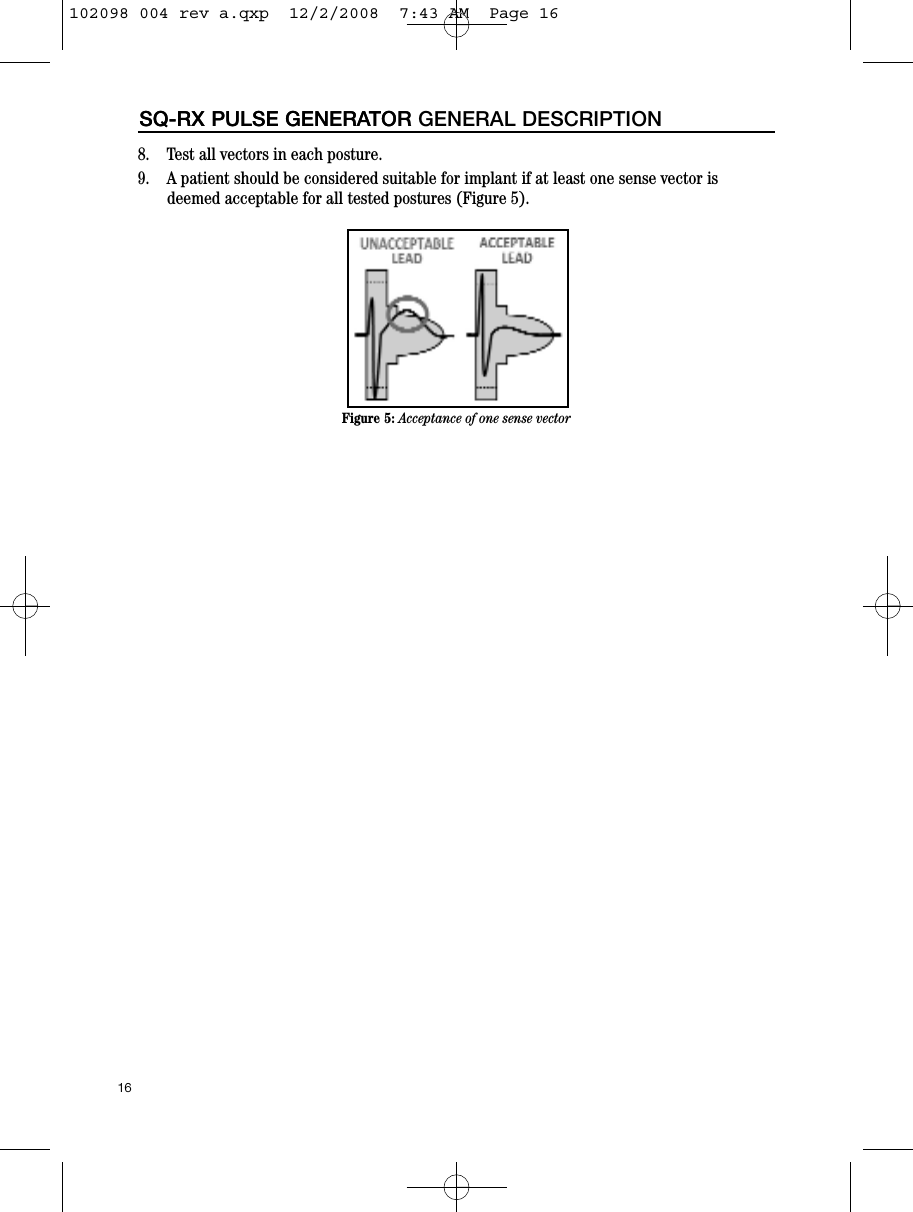 8.    Test all vectors in each posture.9.    A patient should be considered suitable for implant if at least one sense vector isdeemed acceptable for all tested postures (Figure 5).16SQ-RX PULSE GENERATORSQ-RX PULSE GENERATOR GENERAL DESCRIPTIONFigure 5: Acceptance of one sense vector102098 004 rev a.qxp  12/2/2008  7:43 AM  Page 16