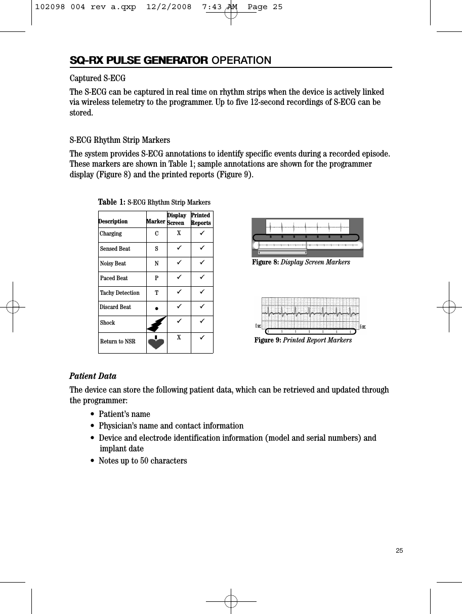 25SQ-RX PULSE GENERATORSQ-RX PULSE GENERATOR OPERATIONCaptured S-ECGThe S-ECG can be captured in real time on rhythm strips when the device is actively linkedvia wireless telemetry to the programmer. Up to five 12-second recordings of S-ECG can bestored.S-ECG Rhythm Strip MarkersThe system provides S-ECG annotations to identify specific events during a recorded episode.These markers are shown in Table 1; sample annotations are shown for the programmerdisplay (Figure 8) and the printed reports (Figure 9).Patient DataThe device can store the following patient data, which can be retrieved and updated throughthe programmer:•  Patient’s name•  Physician’s name and contact information•  Device and electrode identification information (model and serial numbers) andimplant date•  Notes up to 50 charactersTable 1: S-ECG Rhythm Strip MarkersDescription MarkerDisplayScreenPrinted ReportsCharging CX3Sensed Beat S3 3Noisy Beat N3 3Paced Beat P3 3Tachy Detection T3 3Discard Beat •3 3Shock 3 3Return to NSR X3Figure 8: Display Screen MarkersFigure 9: Printed Report Markers102098 004 rev a.qxp  12/2/2008  7:43 AM  Page 25