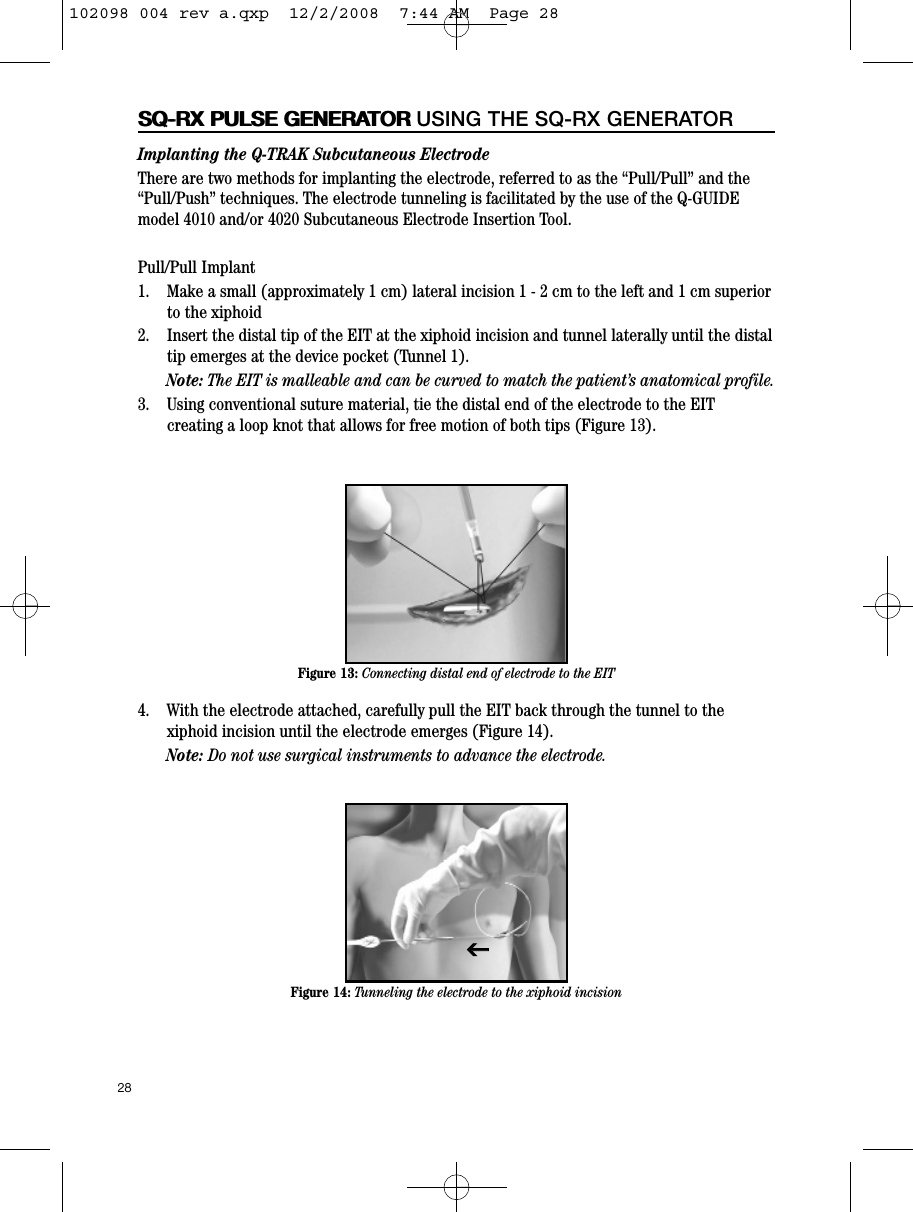 28SQ-RX PULSE GENERATORSQ-RX PULSE GENERATOR USING THE SQ-RX GENERATORImplanting the Q-TRAK Subcutaneous ElectrodeThere are two methods for implanting the electrode, referred to as the “Pull/Pull” and the“Pull/Push” techniques. The electrode tunneling is facilitated by the use of the Q-GUIDEmodel 4010 and/or 4020 Subcutaneous Electrode Insertion Tool.Pull/Pull Implant1.    Make a small (approximately 1 cm) lateral incision 1 - 2 cm to the left and 1 cm superiorto the xiphoid2.    Insert the distal tip of the EIT at the xiphoid incision and tunnel laterally until the distaltip emerges at the device pocket (Tunnel 1).Note: The EIT is malleable and can be curved to match the patient’s anatomical profile.3.    Using conventional suture material, tie the distal end of the electrode to the EITcreating a loop knot that allows for free motion of both tips (Figure 13).4.    With the electrode attached, carefully pull the EIT back through the tunnel to thexiphoid incision until the electrode emerges (Figure 14).Note: Do not use surgical instruments to advance the electrode.Figure 14: Tunneling the electrode to the xiphoid incisionFigure 13: Connecting distal end of electrode to the EITII102098 004 rev a.qxp  12/2/2008  7:44 AM  Page 28