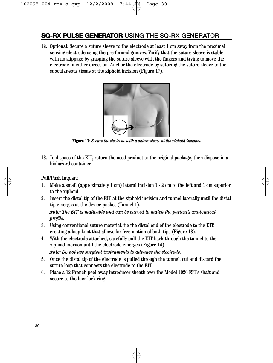 30SQ-RX PULSE GENERATORSQ-RX PULSE GENERATOR USING THE SQ-RX GENERATOR12.  Optional: Secure a suture sleeve to the electrode at least 1 cm away from the proximalsensing electrode using the pre-formed grooves. Verify that the suture sleeve is stablewith no slippage by grasping the suture sleeve with the fingers and trying to move theelectrode in either direction. Anchor the electrode by suturing the suture sleeve to thesubcutaneous tissue at the xiphoid incision (Figure 17).13.  To dispose of the EIT, return the used product to the original package, then dispose in abiohazard container.Pull/Push Implant1.    Make a small (approximately 1 cm) lateral incision 1 - 2 cm to the left and 1 cm superiorto the xiphoid.2.    Insert the distal tip of the EIT at the xiphoid incision and tunnel laterally until the distaltip emerges at the device pocket (Tunnel 1).Note: The EIT is malleable and can be curved to match the patient’s anatomicalprofile.3.    Using conventional suture material, tie the distal end of the electrode to the EIT,creating a loop knot that allows for free motion of both tips (Figure 13).4.    With the electrode attached, carefully pull the EIT back through the tunnel to thexiphoid incision until the electrode emerges (Figure 14).Note: Do not use surgical instruments to advance the electrode.5.    Once the distal tip of the electrode is pulled through the tunnel, cut and discard thesuture loop that connects the electrode to the EIT.6.    Place a 12 French peel-away introducer sheath over the Model 4020 EIT’s shaft andsecure to the luer-lock ring.Figure 17: Secure the electrode with a suture sleeve at the xiphoid incisionI102098 004 rev a.qxp  12/2/2008  7:44 AM  Page 30