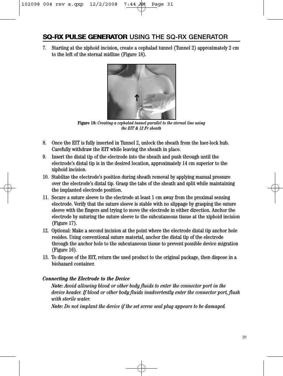 31SQ-RX PULSE GENERATORSQ-RX PULSE GENERATOR USING THE SQ-RX GENERATOR7.    Starting at the xiphoid incision, create a cephalad tunnel (Tunnel 2) approximately 2 cmto the left of the sternal midline (Figure 18).8.    Once the EIT is fully inserted in Tunnel 2, unlock the sheath from the luer-lock hub.Carefully withdraw the EIT while leaving the sheath in place.9.    Insert the distal tip of the electrode into the sheath and push through until theelectrode’s distal tip is in the desired location, approximately 14 cm superior to thexiphoid incision.10.  Stabilize the electrode’s position during sheath removal by applying manual pressureover the electrode’s distal tip. Grasp the tabs of the sheath and split while maintainingthe implanted electrode position.11.  Secure a suture sleeve to the electrode at least 1 cm away from the proximal sensingelectrode. Verify that the suture sleeve is stable with no slippage by grasping the suturesleeve with the fingers and trying to move the electrode in either direction. Anchor theelectrode by suturing the suture sleeve to the subcutaneous tissue at the xiphoid incision(Figure 17).12.  Optional: Make a second incision at the point where the electrode distal tip anchor holeresides. Using conventional suture material, anchor the distal tip of the electrodethrough the anchor hole to the subcutaneous tissue to prevent possible device migration(Figure 16). 13.  To dispose of the EIT, return the used product to the original package, then dispose in abiohazard container.Connecting the Electrode to the DeviceNote: Avoid allowing blood or other body fluids to enter the connector port in thedevice header. If blood or other body fluids inadvertently enter the connector port, flushwith sterile water.Note: Do not implant the device if the set screw seal plug appears to be damaged.Figure 18: Creating a cephalad tunnel parallel to the sternal line usingthe EIT &amp; 12 Fr sheathII102098 004 rev a.qxp  12/2/2008  7:44 AM  Page 31