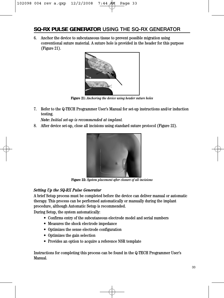 6.    Anchor the device to subcutaneous tissue to prevent possible migration usingconventional suture material. A suture hole is provided in the header for this purpose(Figure 21).7.    Refer to the Q-TECH Programmer User’s Manual for set-up instructions and/or inductiontesting.Note: Initial set-up is recommended at implant.8.    After device set-up, close all incisions using standard suture protocol (Figure 22).Setting Up the SQ-RX Pulse Generator A brief Setup process must be completed before the device can deliver manual or automatictherapy. This process can be performed automatically or manually during the implantprocedure, although Automatic Setup is recommended.During Setup, the system automatically:•  Confirms entry of the subcutaneous electrode model and serial numbers•  Measures the shock electrode impedance•  Optimizes the sense electrode configuration•  Optimizes the gain selection•  Provides an option to acquire a reference NSR templateInstructions for completing this process can be found in the Q-TECH Programmer User’sManual.33SQ-RX PULSE GENERATORSQ-RX PULSE GENERATOR USING THE SQ-RX GENERATORFigure 21: Anchoring the device using header suture holesFigure 22: System placement after closure of all incisions102098 004 rev a.qxp  12/2/2008  7:44 AM  Page 33