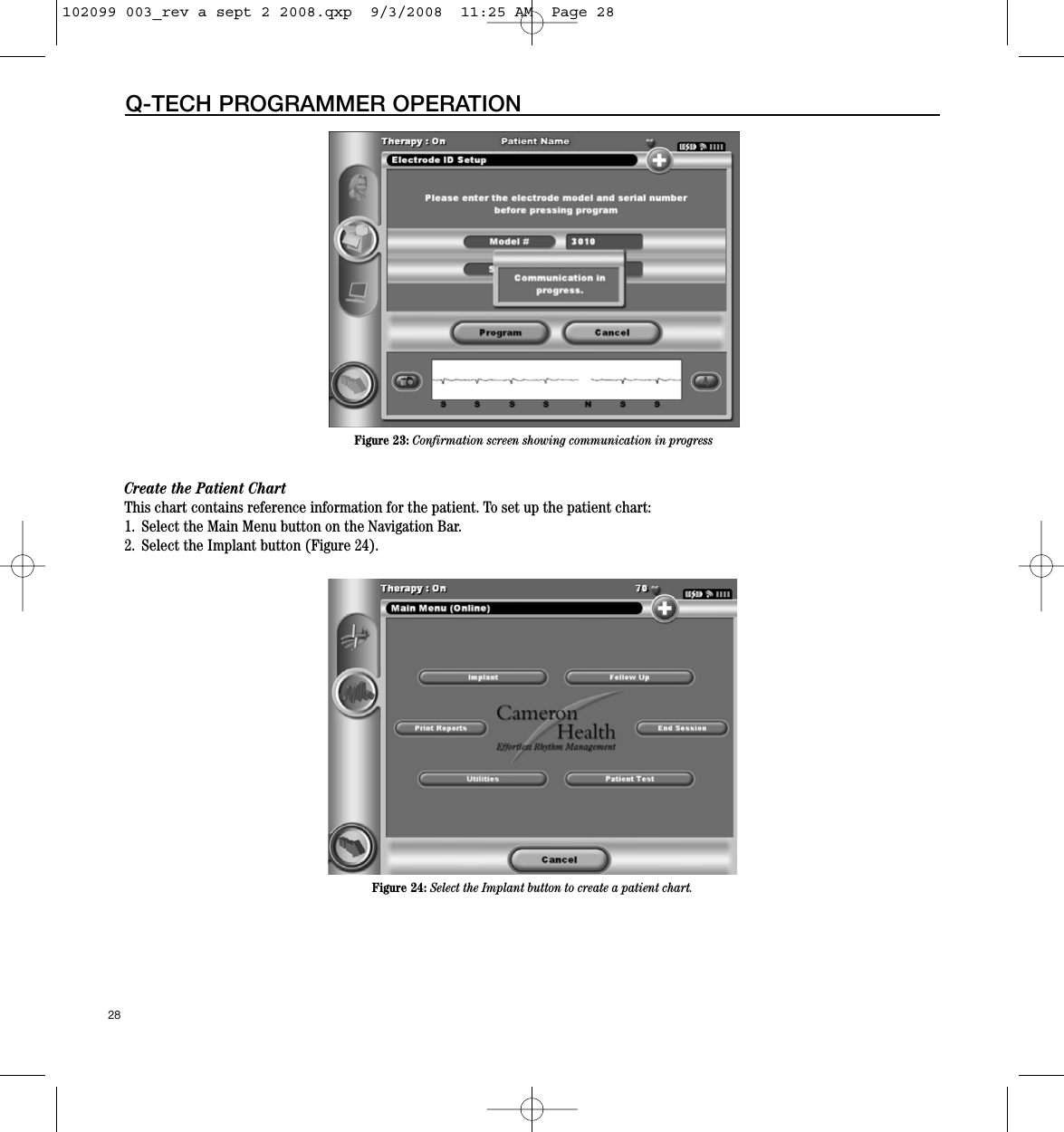 28Q-TECH PROGRAMMER OPERATIONCreate the Patient ChartThis chart contains reference information for the patient. To set up the patient chart:1. Select the Main Menu button on the Navigation Bar.  2. Select the Implant button (Figure 24).Figure 23: Confirmation screen showing communication in progressFigure 24: Select the Implant button to create a patient chart.102099 003_rev a sept 2 2008.qxp  9/3/2008  11:25 AM  Page 28