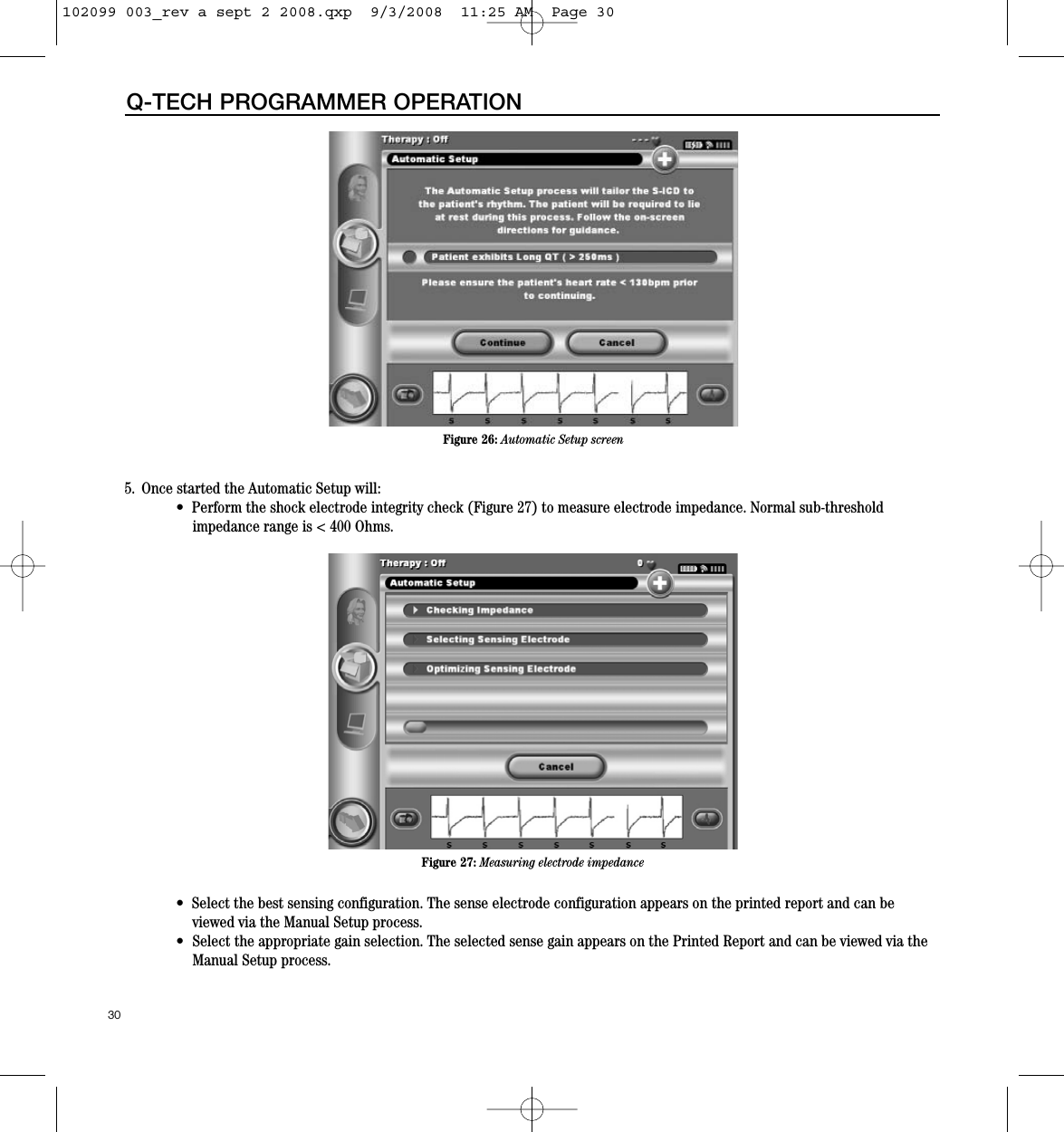 5.  Once started the Automatic Setup will:•  Perform the shock electrode integrity check (Figure 27) to measure electrode impedance. Normal sub-threshold impedance range is &lt; 400 Ohms.•  Select the best sensing configuration. The sense electrode configuration appears on the printed report and can beviewed via the Manual Setup process.• Select the appropriate gain selection. The selected sense gain appears on the Printed Report and can be viewed via theManual Setup process.30Q-TECH PROGRAMMER OPERATIONFigure 26: Automatic Setup screenFigure 27: Measuring electrode impedance102099 003_rev a sept 2 2008.qxp  9/3/2008  11:25 AM  Page 30