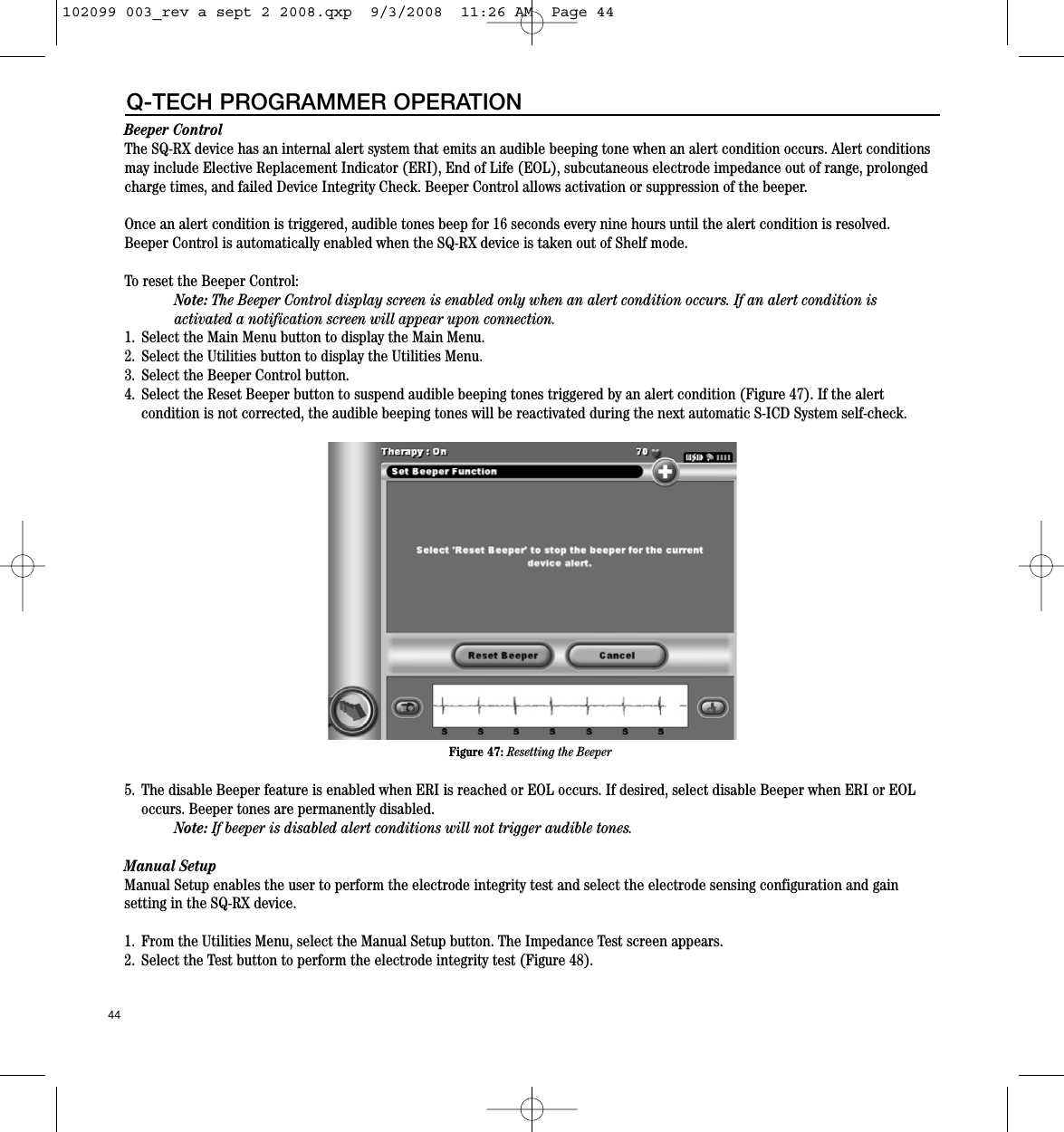 Beeper Control The SQ-RX device has an internal alert system that emits an audible beeping tone when an alert condition occurs. Alert conditionsmay include Elective Replacement Indicator (ERI), End of Life (EOL), subcutaneous electrode impedance out of range, prolongedcharge times, and failed Device Integrity Check. Beeper Control allows activation or suppression of the beeper.Once an alert condition is triggered, audible tones beep for 16 seconds every nine hours until the alert condition is resolved.Beeper Control is automatically enabled when the SQ-RX device is taken out of Shelf mode.To reset the Beeper Control:Note: The Beeper Control display screen is enabled only when an alert condition occurs. If an alert condition is activated a notification screen will appear upon connection.1. Select the Main Menu button to display the Main Menu.2. Select the Utilities button to display the Utilities Menu.3. Select the Beeper Control button. 4. Select the Reset Beeper button to suspend audible beeping tones triggered by an alert condition (Figure 47). If the alert condition is not corrected, the audible beeping tones will be reactivated during the next automatic S-ICD System self-check.5. The disable Beeper feature is enabled when ERI is reached or EOL occurs. If desired, select disable Beeper when ERI or EOLoccurs. Beeper tones are permanently disabled.Note: If beeper is disabled alert conditions will not trigger audible tones.  Manual SetupManual Setup enables the user to perform the electrode integrity test and select the electrode sensing configuration and gain setting in the SQ-RX device.1. From the Utilities Menu, select the Manual Setup button. The Impedance Test screen appears.2. Select the Test button to perform the electrode integrity test (Figure 48). 44Q-TECH PROGRAMMER OPERATIONFigure 47: Resetting the Beeper102099 003_rev a sept 2 2008.qxp  9/3/2008  11:26 AM  Page 44