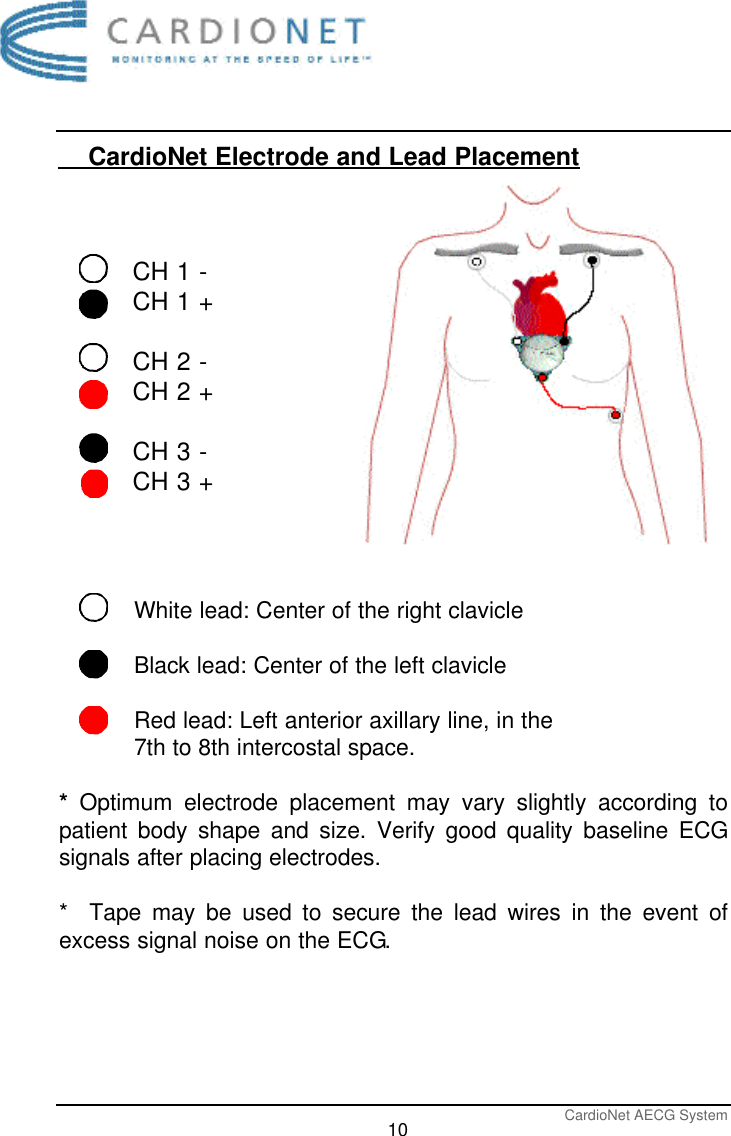 CardioNet AECG System10    CardioNet Electrode and Lead PlacementCH 1 -CH 1 +CH 2 -CH 2 +CH 3 -CH 3 +White lead: Center of the right clavicleBlack lead: Center of the left clavicleRed lead: Left anterior axillary line, in the 7th to 8th intercostal space. *Optimum electrode placement may vary slightly according topatient body shape and size. Verify good quality baseline ECGsignals after placing electrodes.*  Tape may be used to secure the lead wires in the event ofexcess signal noise on the ECG.