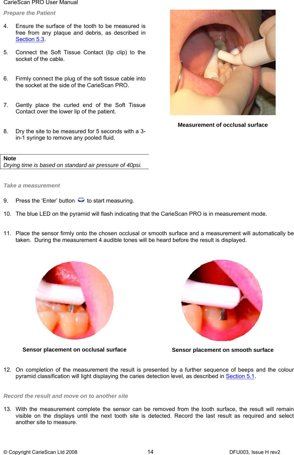 CarieScan PRO User Manual  © Copyright CarieScan Ltd 2008        14               DFU003, Issue H rev2  Take a measurement   9.  Press the ‘Enter’ button   to start measuring.  10.  The blue LED on the pyramid will flash indicating that the CarieScan PRO is in measurement mode.   11.  Place the sensor firmly onto the chosen occlusal or smooth surface and a measurement will automatically be taken.  During the measurement 4 audible tones will be heard before the result is displayed.    12.  On completion of the measurement the result is presented by a further sequence of beeps and the colour pyramid classification will light displaying the caries detection level, as described in Section 5.1.   Record the result and move on to another site  13.  With the measurement complete the sensor can be removed from the tooth surface, the result will remain visible on the displays until the next tooth site is detected. Record the last result as required and select another site to measure.  Prepare the Patient  4.  Ensure the surface of the tooth to be measured is free from any plaque and debris, as described in Section 5.3. 5.  Connect the Soft Tissue Contact (lip clip) to the socket of the cable.   6.  Firmly connect the plug of the soft tissue cable into the socket at the side of the CarieScan PRO.     7.  Gently place the curled end of the Soft Tissue Contact over the lower lip of the patient.   8.  Dry the site to be measured for 5 seconds with a 3-in-1 syringe to remove any pooled fluid.    Note  Drying time is based on standard air pressure of 40psi.     Measurement of occlusal surface    Sensor placement on occlusal surface   Sensor placement on smooth surface 