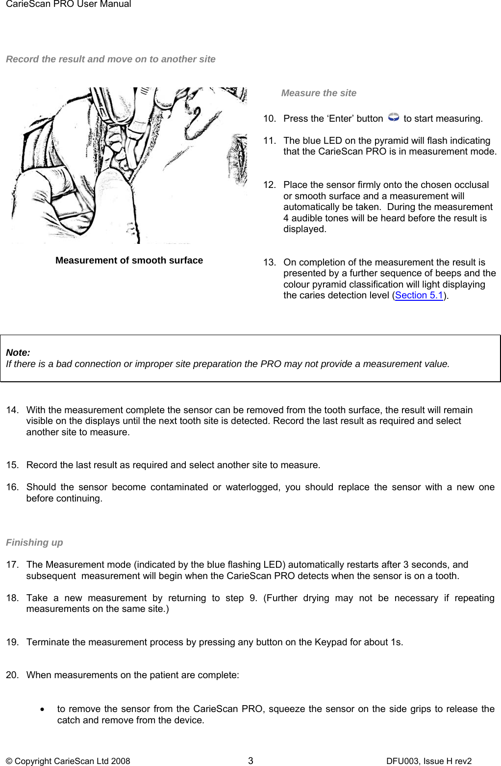 CarieScan PRO User Manual  © Copyright CarieScan Ltd 2008        3               DFU003, Issue H rev2    Record the result and move on to another site    Note:  If there is a bad connection or improper site preparation the PRO may not provide a measurement value.    14.  With the measurement complete the sensor can be removed from the tooth surface, the result will remain visible on the displays until the next tooth site is detected. Record the last result as required and select another site to measure.   15.  Record the last result as required and select another site to measure.  16.  Should the sensor become contaminated or waterlogged, you should replace the sensor with a new one before continuing.    Finishing up  17.  The Measurement mode (indicated by the blue flashing LED) automatically restarts after 3 seconds, and subsequent  measurement will begin when the CarieScan PRO detects when the sensor is on a tooth.   18.  Take a new measurement by returning to step 9. (Further drying may not be necessary if repeating measurements on the same site.)   19.  Terminate the measurement process by pressing any button on the Keypad for about 1s.   20.  When measurements on the patient are complete:   •  to remove the sensor from the CarieScan PRO, squeeze the sensor on the side grips to release the catch and remove from the device.    Measurement of smooth surface    Measure the site  10.  Press the ‘Enter’ button   to start measuring.  11.  The blue LED on the pyramid will flash indicating that the CarieScan PRO is in measurement mode.   12.  Place the sensor firmly onto the chosen occlusal or smooth surface and a measurement will automatically be taken.  During the measurement 4 audible tones will be heard before the result is displayed.   13.  On completion of the measurement the result is presented by a further sequence of beeps and the colour pyramid classification will light displaying the caries detection level (Section 5.1).     