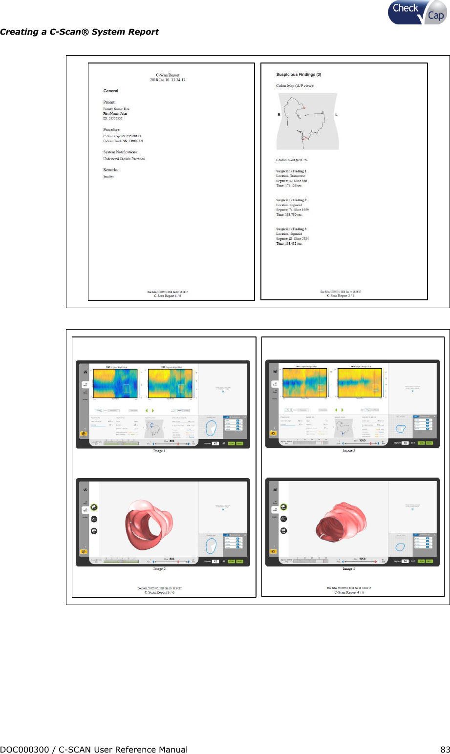 Page 83 of Check Cap CAP10007506 C-Scan Cap transceiver User Manual Title