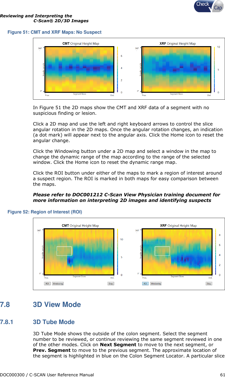 Page 61 of Check Cap TRACK10007605 C-Scan track transceiver User Manual Title