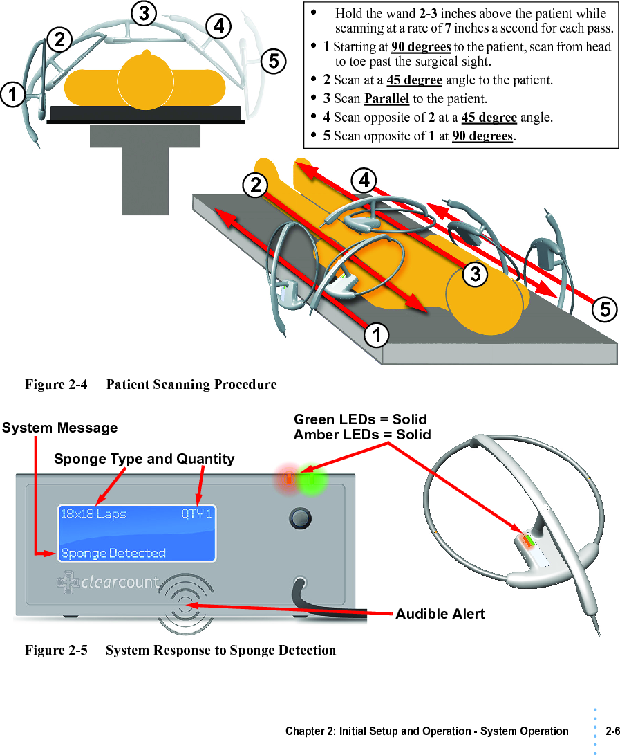 Chapter 2: Initial Setup and Operation - System Operation 2-6• • • •••Figure 2-4     Patient Scanning ProcedureFigure 2-5     System Response to Sponge Detection112345234•Hold the wand 2-3 inches above the patient while scanning at a rate of 7 inches a second for each pass.•1 Starting at 90 degrees to the patient, scan from head to toe past the surgical sight. •2 Scan at a 45 degree angle to the patient.•3 Scan Parallel to the patient.•4 Scan opposite of 2 at a 45 degree angle.•5 Scan opposite of 1 at 90 degrees.5System MessageSponge Type and QuantityGreen LEDs = Solid Amber LEDs = SolidAudible Alert