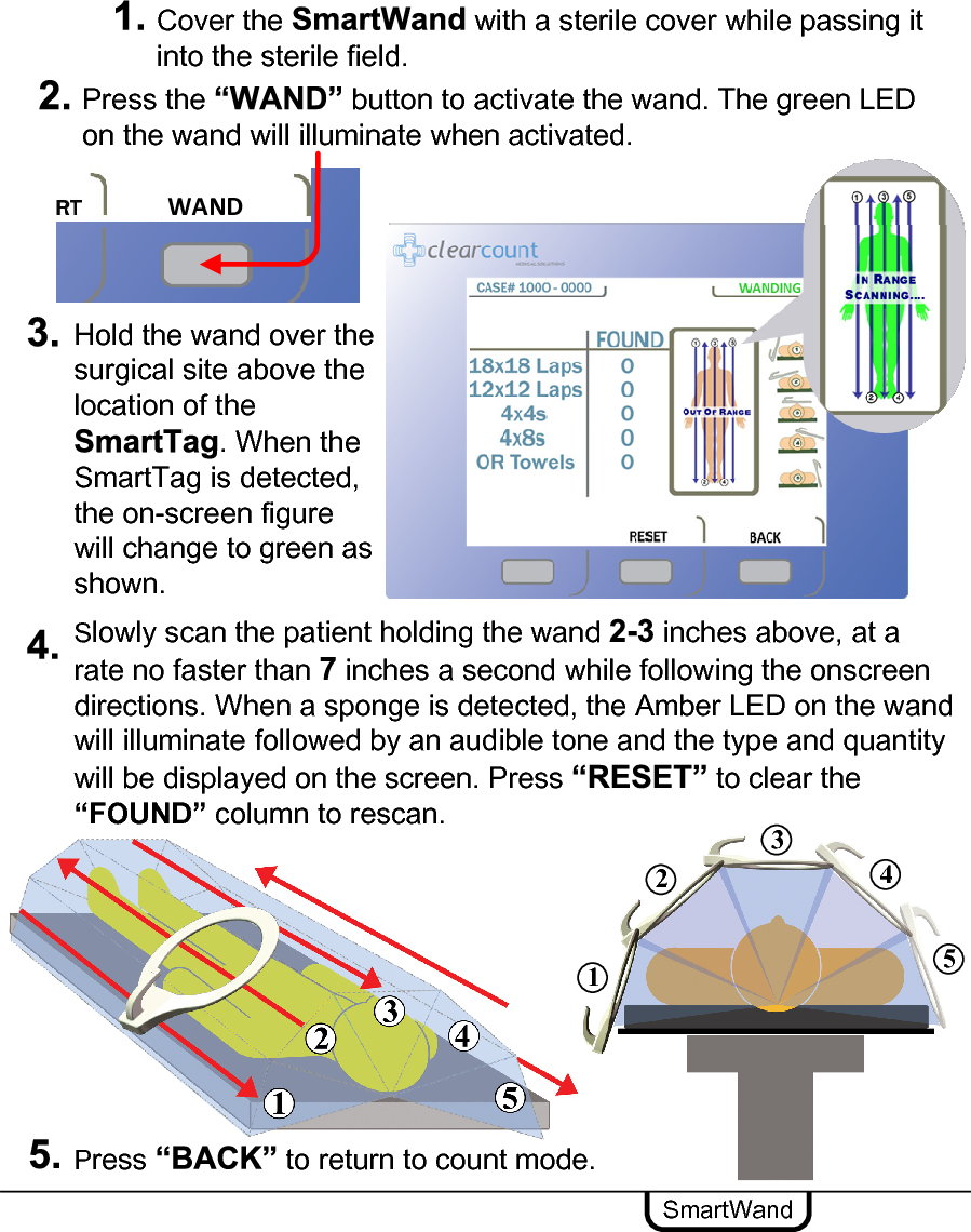 Hold the wand over the surgical site above the location of the . When the SmartTag is detected, the on-screen figure will change to green as shown.SmartWandSlowly scan the patient holding the wand  inches above, at a rate no faster than  inches a second while following the onscreen directions. When a sponge is detected, the Amber LED on the wand will illuminate followed by an audible tone and the type and quantity will be displayed on the screen. Press  to clear the “FOUND” column to rescan.Cover the  with a sterile cover while passing it into the sterile field. Press the  button to activate the wand. The green LED on the wand will illuminate when activated.Press  to return to count mode. 12345WAND