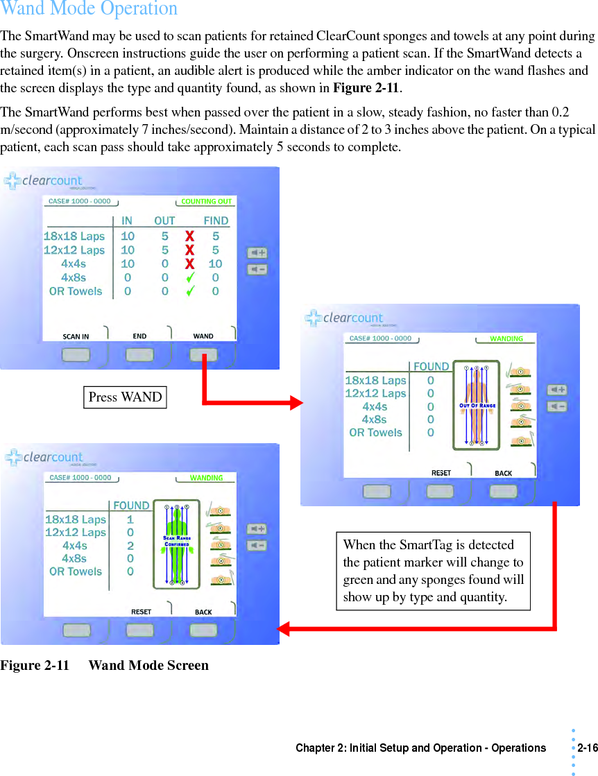 Chapter 2: Initial Setup and Operation - Operations 2-16 • • • •••Wand Mode OperationThe SmartWand may be used to scan patients for retained ClearCount sponges and towels at any point during the surgery. Onscreen instructions guide the user on performing a patient scan. If the SmartWand detects a retained item(s) in a patient, an audible alert is produced while the amber indicator on the wand flashes and the screen displays the type and quantity found, as shown in Figure 2-11.The SmartWand performs best when passed over the patient in a slow, steady fashion, no faster than 0.2 m/second (approximately 7 inches/second). Maintain a distance of 2 to 3 inches above the patient. On a typical patient, each scan pass should take approximately 5 seconds to complete.Figure 2-11     Wand Mode ScreenPress WANDWhen the SmartTag is detected the patient marker will change to green and any sponges found will show up by type and quantity.