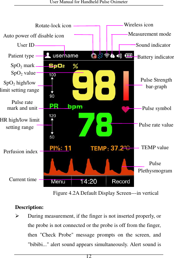 User Manual for Handheld Pulse Oximeter    12                          Description:  During measurement, if the finger is not inserted properly, or the probe is not connected or the probe is off from the finger, then  &quot;Check  Probe&quot;  message  prompts  on  the  screen,  and &quot;bibibi...&quot; alert sound appears simultaneously. Alert sound is SpO2 mark SpO2 value Pulse   Plethysmogram Current time SpO2 high/low limit setting range Patient type Sound indicator   Battery indicator Pulse rate   mark and unit Pulse Strength   bar-graph Pulse symbol Pulse rate value Figure 4.2A Default Display Screen---in vertical  HR high/low limit setting range User ID Measurement mode Auto power off disable icon Wireless icon Rotate-lock icon TEMP value Perfusion index 