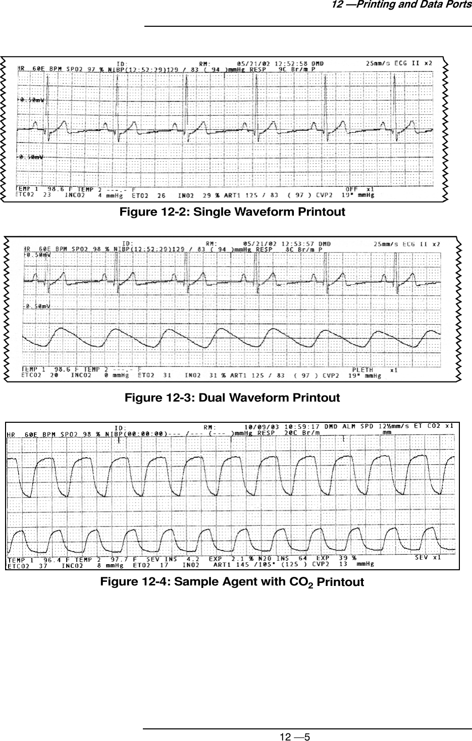 12 —512 —Printing and Data PortsFigure 12-2: Single Waveform PrintoutFigure 12-3: Dual Waveform PrintoutFigure 12-4: Sample Agent with CO2 Printout
