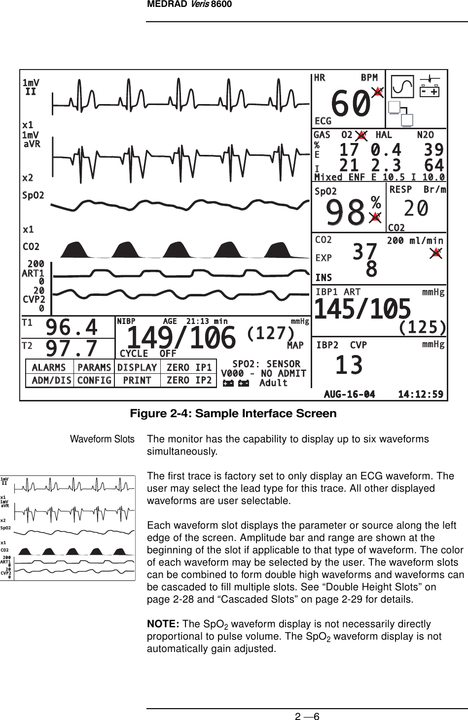 MEDRAD Veris 86002 —6Figure 2-4: Sample Interface ScreenWaveform SlotsThe monitor has the capability to display up to six waveforms simultaneously.The first trace is factory set to only display an ECG waveform. The user may select the lead type for this trace. All other displayed waveforms are user selectable.Each waveform slot displays the parameter or source along the left edge of the screen. Amplitude bar and range are shown at the beginning of the slot if applicable to that type of waveform. The color of each waveform may be selected by the user. The waveform slots can be combined to form double high waveforms and waveforms can be cascaded to fill multiple slots. See “Double Height Slots” on page 2-28 and “Cascaded Slots” on page 2-29 for details.NOTE: The SpO2 waveform display is not necessarily directly proportional to pulse volume. The SpO2 waveform display is not automatically gain adjusted.ALARMS  PARAMS DISPLAYALARMS  PARAMS DISPLAYAdultAdultV000 - NO ADMITV000 - NO ADMITSPO2: SENSORSPO2: SENSORZERO IP1ZERO IP1ZERO IP2ZERO IP2ADM/DIS CONFIG  PRINTADM/DIS CONFIG  PRINTAUG-16-04    14:12:59AUG-16-04    14:12:59SpO2SpO2IIII002020T1T1T2T2%x1x1x1x1x2x2aVRaVRCO2CO2CO2CO2EXPEXPINSINSINSINSINSINSMAPMAPCYCLE  OFFCYCLE  OFF2002001mV1mVECGECGSpO2SpO2IBP1 ARTIBP1 ARTmmHgmmHgmmHgmmHg200 ml/min200 ml/minIBP2  CVPIBP2  CVPHRHRBPMBPMRESP  Br/mRESP  Br/m1mV1mV606098983737 8 896.496.497.797.720201313(125)(125)O2    HALO2    HALGASGASN2ON2OEI17 0.4  3917 0.4  3921 2.3  6421 2.3  64145/105145/105ART1ART1CVP2CVP2149/106149/106(127)(127)CO2CO2- +NIBP      AGE  21:13 minNIBP      AGE  21:13 minmmHgmmHg%Mixed ENF E 10.5 I 10.0Mixed ENF E 10.5 I 10.0- + - +SpO2SpO2IIII002020x1x1x1x1x2x2aVRaVRCO2CO22002001mV1mV1mV1mVART1ART1CVP2CVP2