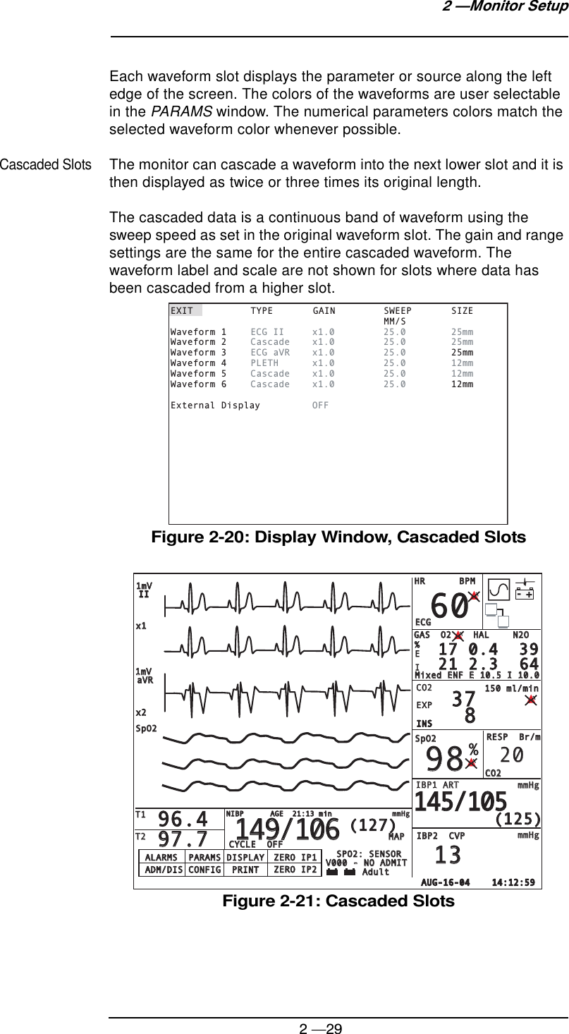 2 —292 —Monitor SetupEach waveform slot displays the parameter or source along the left edge of the screen. The colors of the waveforms are user selectable in the PARAMS window. The numerical parameters colors match the selected waveform color whenever possible.Cascaded SlotsThe monitor can cascade a waveform into the next lower slot and it is then displayed as twice or three times its original length.The cascaded data is a continuous band of waveform using the sweep speed as set in the original waveform slot. The gain and range settings are the same for the entire cascaded waveform. The waveform label and scale are not shown for slots where data has been cascaded from a higher slot.Figure 2-20: Display Window, Cascaded SlotsFigure 2-21: Cascaded SlotsEXIT TYPE GAIN SWEEP SIZE   MM/SWaveform 1   ECG II  x1.0  25.0  25mmWaveform 2   Cascade x1.0  25.0  25mmWaveform 3   ECG aVR  x1.0  25.0  25mmWaveform 4   PLETH x1.0  25.0  12mmWaveform 5   Cascade x1.0  25.0  12mmWaveform 6   Cascade x1.0  25.0  12mmExternal Display  OFFALARMS  PARAMS DISPLAYALARMS  PARAMS DISPLAYAdultAdultV000 - NO ADMITV000 - NO ADMITSPO2: SENSORSPO2: SENSORZERO IP1ZERO IP1ZERO IP2ZERO IP2ADM/DIS CONFIG  PRINTADM/DIS CONFIG  PRINTSpO2SpO2IIIIT1T1T2T2%x1x1x2x2aVRaVRCO2CO2EXPEXPINSINSINSINSINSINS1mV1mVECGECGSpO2SpO2IBP1 ARTIBP1 ARTmmHgmmHgmmHgmmHg150 ml/min150 ml/minIBP2  CVPIBP2  CVPHRHRBPMBPMRESP  Br/mRESP  Br/m1mV1mV606098983737 8 896.496.497.797.720201313(125)(125)145/105145/105- + +- + +CO2CO2- +O2    HALO2    HALGASGASN2ON2OEI17 0.4  3917 0.4  3921 2.3  6421 2.3  64%Mixed ENF E 10.5 I 10.0Mixed ENF E 10.5 I 10.0MAPMAPCYCLE  OFFCYCLE  OFF149/106149/106(127)(127)NIBP      AGE  21:13 minNIBP      AGE  21:13 minmmHgmmHgAUG-16-04    14:12:59AUG-16-04    14:12:59