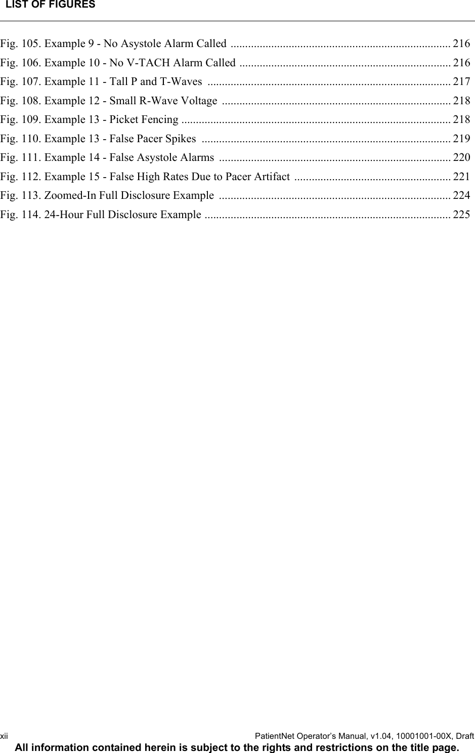 LIST OF FIGURESxii  PatientNet Operator’s Manual, v1.04, 10001001-00X, DraftAll information contained herein is subject to the rights and restrictions on the title page.Fig. 105. Example 9 - No Asystole Alarm Called ............................................................................ 216Fig. 106. Example 10 - No V-TACH Alarm Called ......................................................................... 216Fig. 107. Example 11 - Tall P and T-Waves  .................................................................................... 217Fig. 108. Example 12 - Small R-Wave Voltage  ............................................................................... 218Fig. 109. Example 13 - Picket Fencing ............................................................................................. 218Fig. 110. Example 13 - False Pacer Spikes  ...................................................................................... 219Fig. 111. Example 14 - False Asystole Alarms  ................................................................................ 220Fig. 112. Example 15 - False High Rates Due to Pacer Artifact ...................................................... 221Fig. 113. Zoomed-In Full Disclosure Example  ................................................................................ 224Fig. 114. 24-Hour Full Disclosure Example ..................................................................................... 225