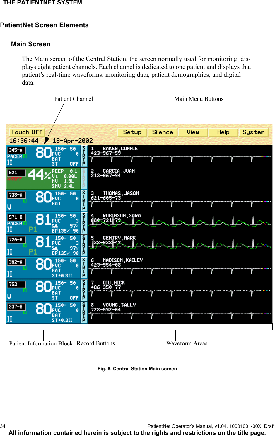 THE PATIENTNET SYSTEM34  PatientNet Operator’s Manual, v1.04, 10001001-00X, DraftAll information contained herein is subject to the rights and restrictions on the title page.PatientNet Screen ElementsMain Screen The Main screen of the Central Station, the screen normally used for monitoring, dis-plays eight patient channels. Each channel is dedicated to one patient and displays that patient’s real-time waveforms, monitoring data, patient demographics, and digital data.Fig. 6. Central Station Main screen Main Menu ButtonsPatient ChannelRecord Buttons Waveform AreasPatient Information Block