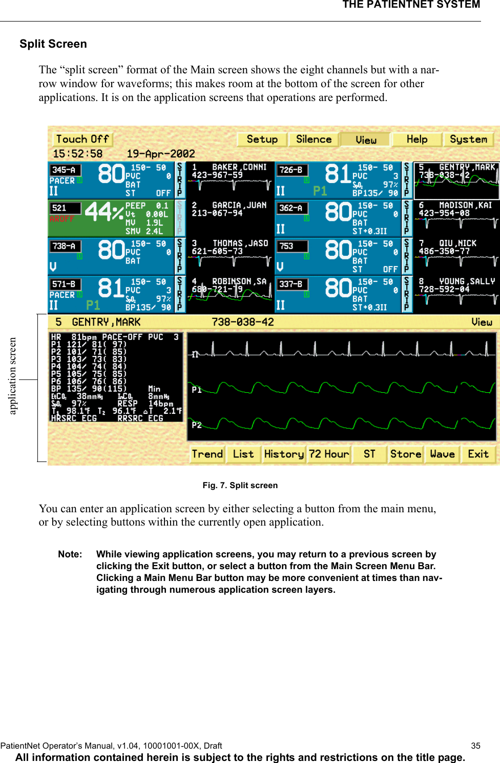 THE PATIENTNET SYSTEMPatientNet Operator’s Manual, v1.04, 10001001-00X, Draft   35All information contained herein is subject to the rights and restrictions on the title page.Split ScreenThe “split screen” format of the Main screen shows the eight channels but with a nar-row window for waveforms; this makes room at the bottom of the screen for other applications. It is on the application screens that operations are performed. Fig. 7. Split screenYou can enter an application screen by either selecting a button from the main menu, or by selecting buttons within the currently open application. Note: While viewing application screens, you may return to a previous screen by clicking the Exit button, or select a button from the Main Screen Menu Bar. Clicking a Main Menu Bar button may be more convenient at times than nav-igating through numerous application screen layers.application screen