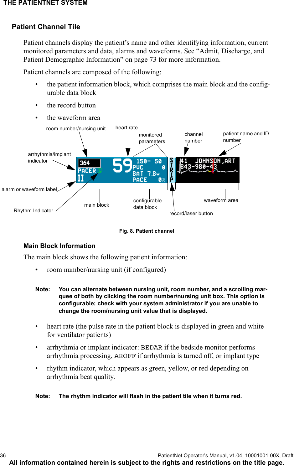 THE PATIENTNET SYSTEM36  PatientNet Operator’s Manual, v1.04, 10001001-00X, DraftAll information contained herein is subject to the rights and restrictions on the title page.Patient Channel TilePatient channels display the patient’s name and other identifying information, current monitored parameters and data, alarms and waveforms. See “Admit, Discharge, and Patient Demographic Information” on page 73 for more information.Patient channels are composed of the following:• the patient information block, which comprises the main block and the config-urable data block• the record button • the waveform area Fig. 8. Patient channelMain Block InformationThe main block shows the following patient information:• room number/nursing unit (if configured)Note: You can alternate between nursing unit, room number, and a scrolling mar-quee of both by clicking the room number/nursing unit box. This option is configurable; check with your system administrator if you are unable to change the room/nursing unit value that is displayed.• heart rate (the pulse rate in the patient block is displayed in green and white for ventilator patients)• arrhythmia or implant indicator: BEDAR if the bedside monitor performs arrhythmia processing, AROFF if arrhythmia is turned off, or implant type• rhythm indicator, which appears as green, yellow, or red depending on arrhythmia beat quality.Note: The rhythm indicator will flash in the patient tile when it turns red.main block waveform areaheart ratemonitored parameterspatient name and ID numberroom number/nursing unitalarm or waveform labelrecord/laser buttonconfigurable data blockchannelnumberarrhythmia/implant indicatorRhythm Indicator