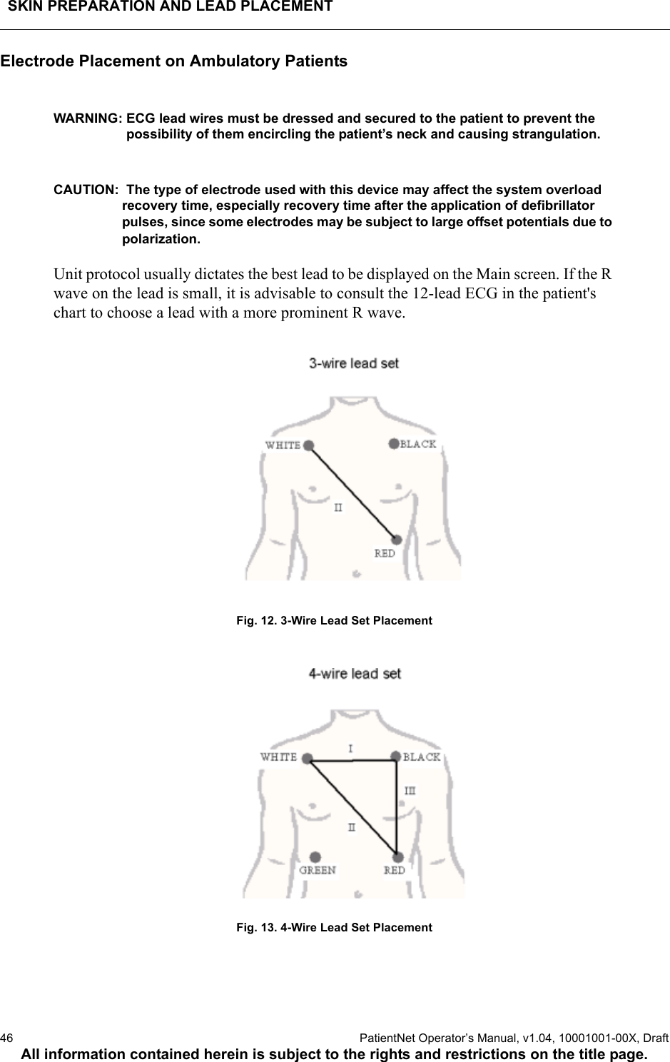 SKIN PREPARATION AND LEAD PLACEMENT46  PatientNet Operator’s Manual, v1.04, 10001001-00X, DraftAll information contained herein is subject to the rights and restrictions on the title page.Electrode Placement on Ambulatory PatientsWARNING: ECG lead wires must be dressed and secured to the patient to prevent the possibility of them encircling the patient’s neck and causing strangulation.CAUTION:  The type of electrode used with this device may affect the system overload recovery time, especially recovery time after the application of defibrillator pulses, since some electrodes may be subject to large offset potentials due to polarization.Unit protocol usually dictates the best lead to be displayed on the Main screen. If the R wave on the lead is small, it is advisable to consult the 12-lead ECG in the patient&apos;s chart to choose a lead with a more prominent R wave.Fig. 12. 3-Wire Lead Set PlacementFig. 13. 4-Wire Lead Set Placement