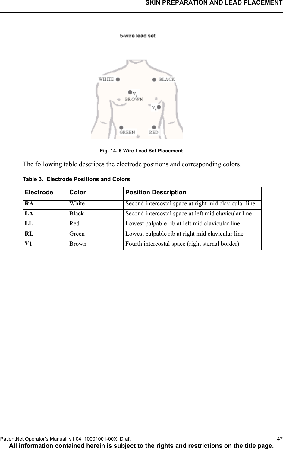 SKIN PREPARATION AND LEAD PLACEMENTPatientNet Operator’s Manual, v1.04, 10001001-00X, Draft   47All information contained herein is subject to the rights and restrictions on the title page.Fig. 14. 5-Wire Lead Set PlacementThe following table describes the electrode positions and corresponding colors.Table 3.  Electrode Positions and ColorsElectrode Color Position DescriptionRA White Second intercostal space at right mid clavicular lineLA Black Second intercostal space at left mid clavicular lineLL Red Lowest palpable rib at left mid clavicular lineRL Green Lowest palpable rib at right mid clavicular lineV1 Brown Fourth intercostal space (right sternal border)