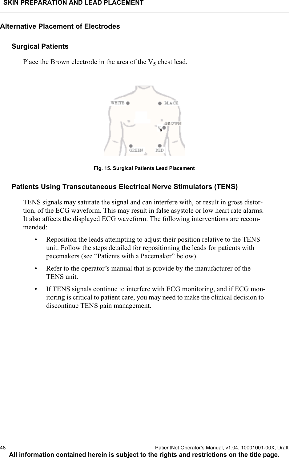 SKIN PREPARATION AND LEAD PLACEMENT48  PatientNet Operator’s Manual, v1.04, 10001001-00X, DraftAll information contained herein is subject to the rights and restrictions on the title page.Alternative Placement of ElectrodesSurgical PatientsPlace the Brown electrode in the area of the V5 chest lead.Fig. 15. Surgical Patients Lead PlacementPatients Using Transcutaneous Electrical Nerve Stimulators (TENS)TENS signals may saturate the signal and can interfere with, or result in gross distor-tion, of the ECG waveform. This may result in false asystole or low heart rate alarms. It also affects the displayed ECG waveform. The following interventions are recom-mended:• Reposition the leads attempting to adjust their position relative to the TENS unit. Follow the steps detailed for repositioning the leads for patients with pacemakers (see “Patients with a Pacemaker” below).• Refer to the operator’s manual that is provide by the manufacturer of the TENS unit.• If TENS signals continue to interfere with ECG monitoring, and if ECG mon-itoring is critical to patient care, you may need to make the clinical decision to discontinue TENS pain management.