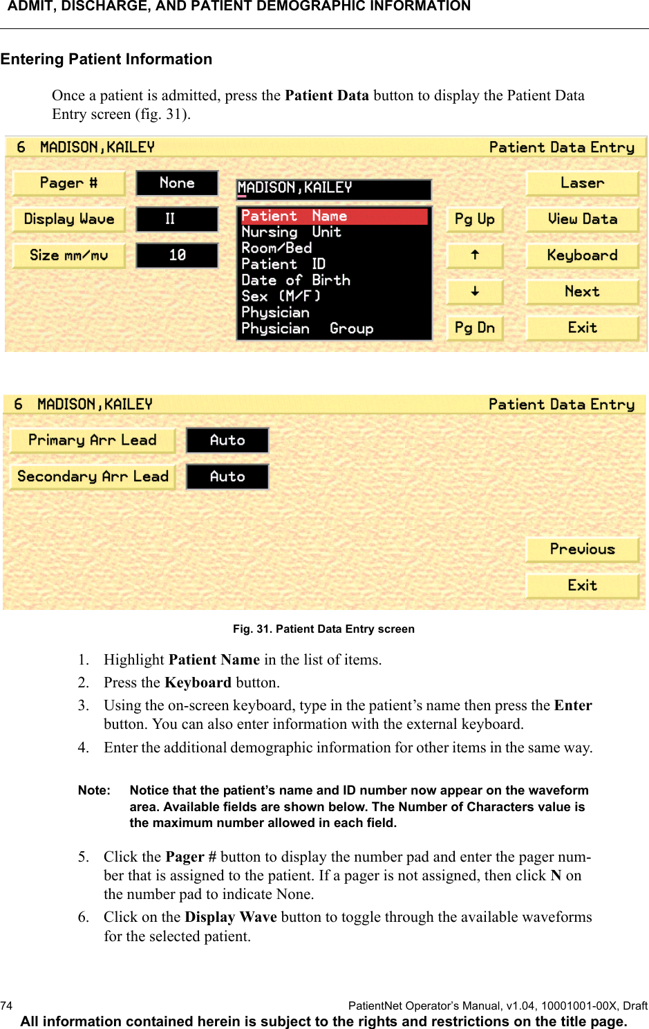 ADMIT, DISCHARGE, AND PATIENT DEMOGRAPHIC INFORMATION74  PatientNet Operator’s Manual, v1.04, 10001001-00X, DraftAll information contained herein is subject to the rights and restrictions on the title page.Entering Patient InformationOnce a patient is admitted, press the Patient Data button to display the Patient Data Entry screen (fig. 31). Fig. 31. Patient Data Entry screen1. Highlight Patient Name in the list of items.2. Press the Keyboard button.3. Using the on-screen keyboard, type in the patient’s name then press the Enter button. You can also enter information with the external keyboard. 4. Enter the additional demographic information for other items in the same way. Note: Notice that the patient’s name and ID number now appear on the waveform area. Available fields are shown below. The Number of Characters value is the maximum number allowed in each field.5. Click the Pager # button to display the number pad and enter the pager num-ber that is assigned to the patient. If a pager is not assigned, then click N on the number pad to indicate None.6. Click on the Display Wave button to toggle through the available waveforms for the selected patient.