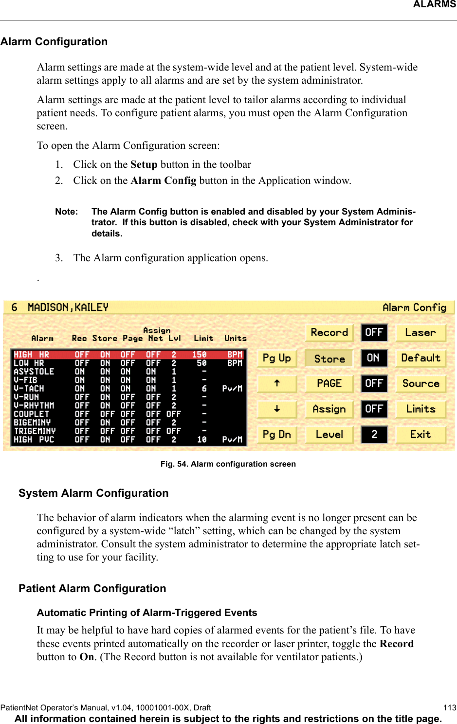 ALARMSPatientNet Operator’s Manual, v1.04, 10001001-00X, Draft   113All information contained herein is subject to the rights and restrictions on the title page.Alarm ConfigurationAlarm settings are made at the system-wide level and at the patient level. System-wide alarm settings apply to all alarms and are set by the system administrator. Alarm settings are made at the patient level to tailor alarms according to individual patient needs. To configure patient alarms, you must open the Alarm Configuration screen.To open the Alarm Configuration screen:1. Click on the Setup button in the toolbar2. Click on the Alarm Config button in the Application window.Note: The Alarm Config button is enabled and disabled by your System Adminis-trator.  If this button is disabled, check with your System Administrator for details.3. The Alarm configuration application opens..Fig. 54. Alarm configuration screenSystem Alarm ConfigurationThe behavior of alarm indicators when the alarming event is no longer present can be configured by a system-wide “latch” setting, which can be changed by the system administrator. Consult the system administrator to determine the appropriate latch set-ting to use for your facility.Patient Alarm ConfigurationAutomatic Printing of Alarm-Triggered EventsIt may be helpful to have hard copies of alarmed events for the patient’s file. To have these events printed automatically on the recorder or laser printer, toggle the Record button to On. (The Record button is not available for ventilator patients.)