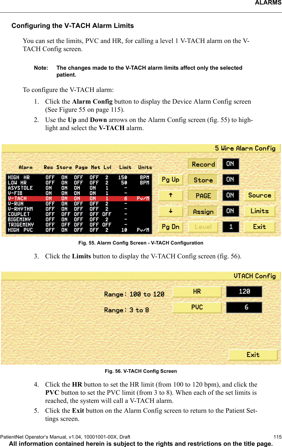 ALARMSPatientNet Operator’s Manual, v1.04, 10001001-00X, Draft   115All information contained herein is subject to the rights and restrictions on the title page.Configuring the V-TACH Alarm LimitsYou can set the limits, PVC and HR, for calling a level 1 V-TACH alarm on the V-TACH Config screen. Note: The changes made to the V-TACH alarm limits affect only the selected patient.To configure the V-TACH alarm:1. Click the Alarm Config button to display the Device Alarm Config screen (See Figure 55 on page 115).2. Use the Up and Down arrows on the Alarm Config screen (fig. 55) to high-light and select the V-TACH alarm.Fig. 55. Alarm Config Screen - V-TACH Configuration3. Click the Limits button to display the V-TACH Config screen (fig. 56).Fig. 56. V-TACH Config Screen4. Click the HR button to set the HR limit (from 100 to 120 bpm), and click the PVC button to set the PVC limit (from 3 to 8). When each of the set limits is reached, the system will call a V-TACH alarm.5. Click the Exit button on the Alarm Config screen to return to the Patient Set-tings screen.