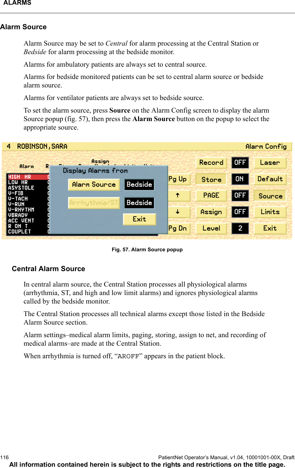 ALARMS116  PatientNet Operator’s Manual, v1.04, 10001001-00X, DraftAll information contained herein is subject to the rights and restrictions on the title page.Alarm SourceAlarm Source may be set to Central for alarm processing at the Central Station or Bedside for alarm processing at the bedside monitor.Alarms for ambulatory patients are always set to central source.Alarms for bedside monitored patients can be set to central alarm source or bedside alarm source.Alarms for ventilator patients are always set to bedside source.To set the alarm source, press Source on the Alarm Config screen to display the alarm Source popup (fig. 57), then press the Alarm Source button on the popup to select the appropriate source.Fig. 57. Alarm Source popupCentral Alarm SourceIn central alarm source, the Central Station processes all physiological alarms (arrhythmia, ST, and high and low limit alarms) and ignores physiological alarms called by the bedside monitor. The Central Station processes all technical alarms except those listed in the Bedside Alarm Source section.Alarm settings–medical alarm limits, paging, storing, assign to net, and recording of medical alarms–are made at the Central Station.When arrhythmia is turned off, “AROFF” appears in the patient block.